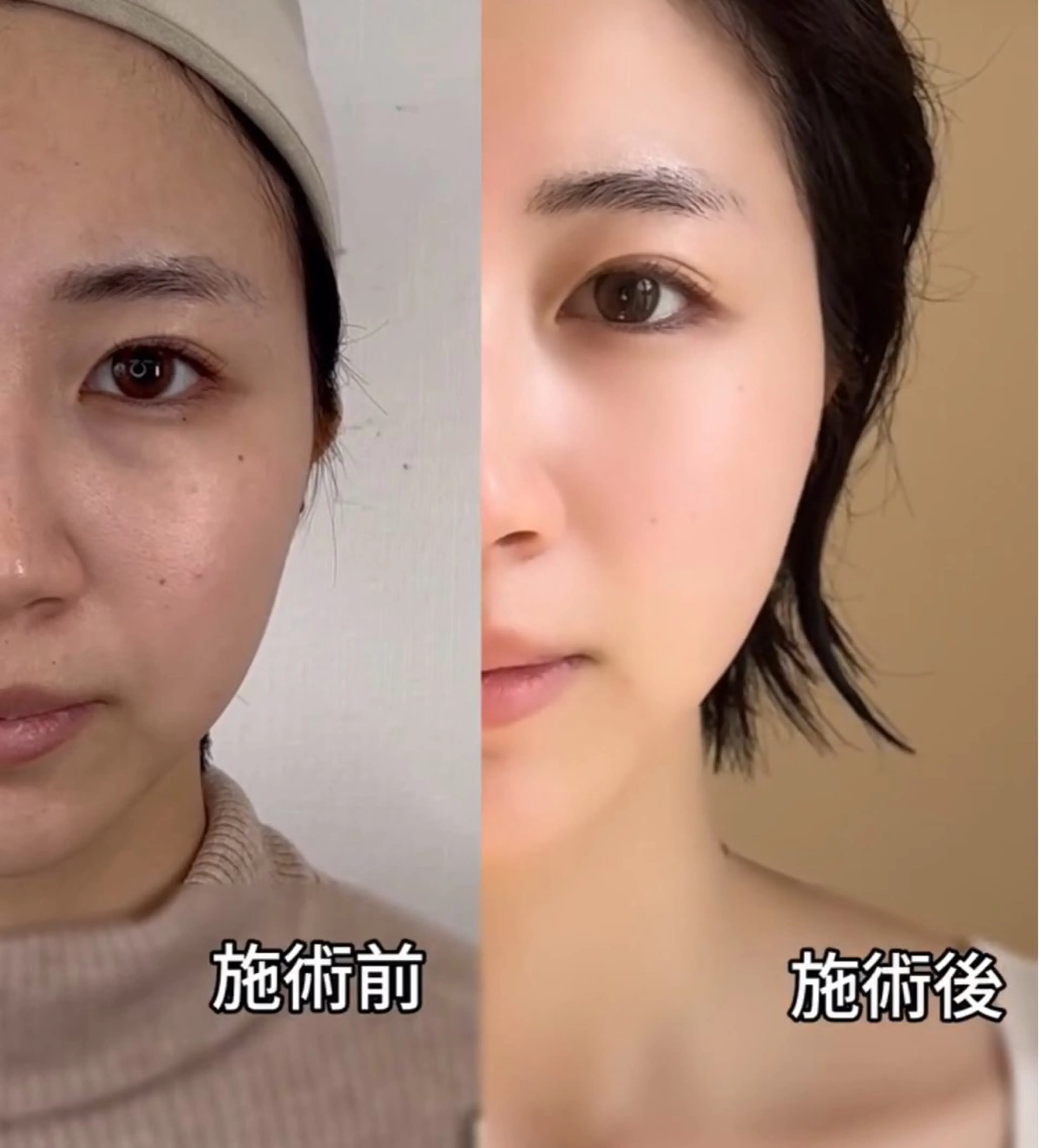 初回限定:韓国最新美容エステの写真