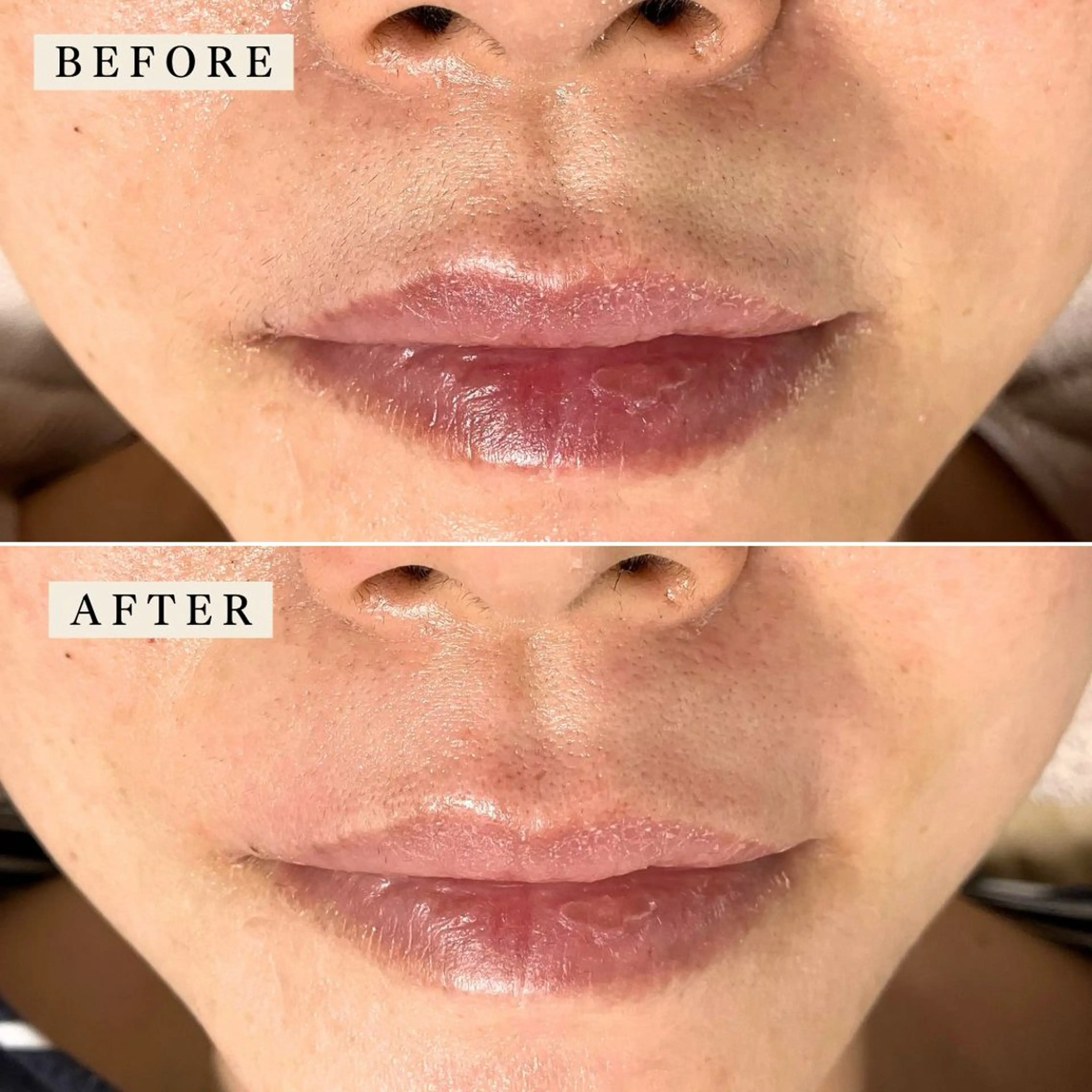 エステ 【産毛・眉毛ケア＆肌質改善サロン】＊BiBi＊beautysalon所属・眉･産毛専門BiBi 糸脱毛スレッティングのエステ・リラクイメージ