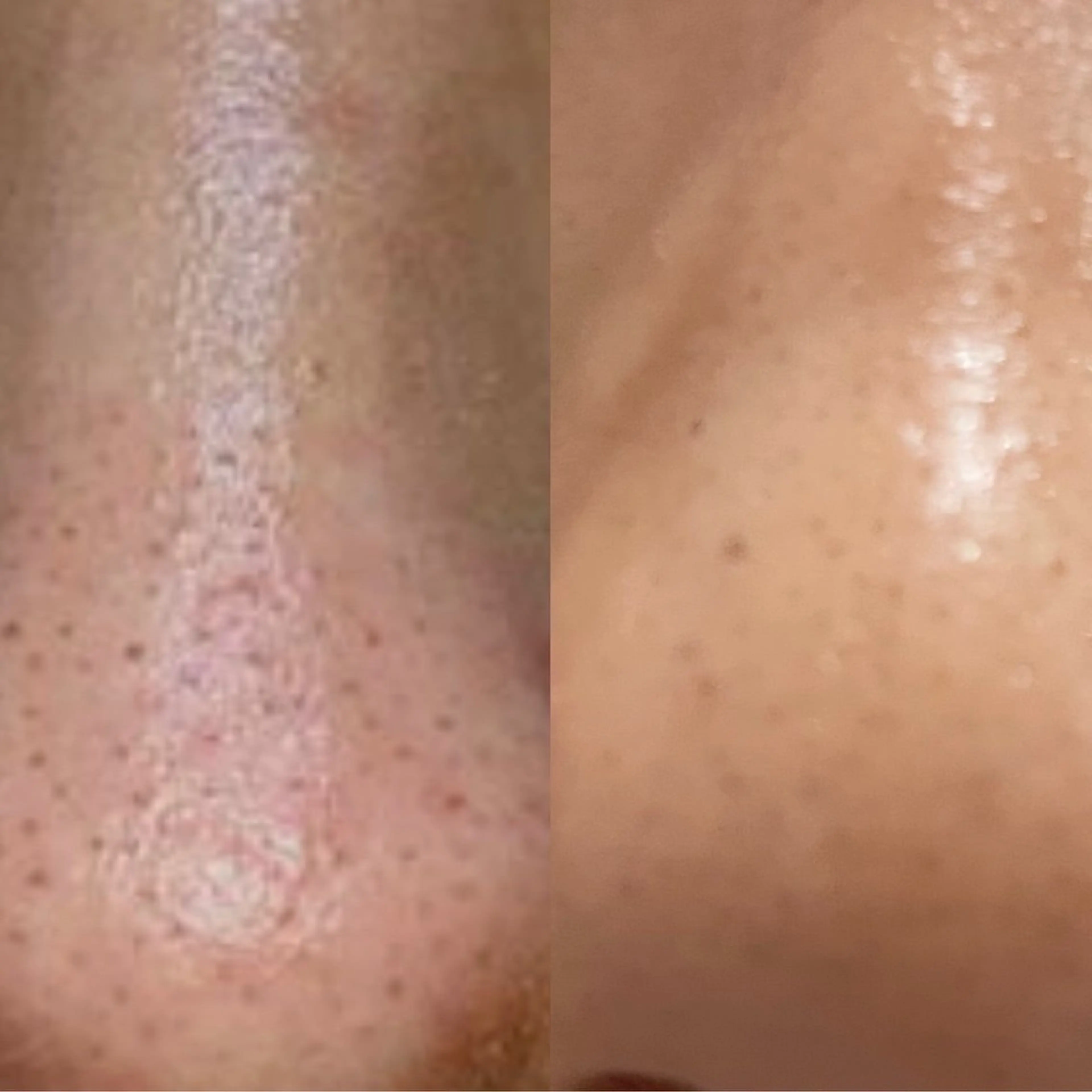 エステ リラク デアイム東広島所属・中井 小春のエステ・リラクイメージ