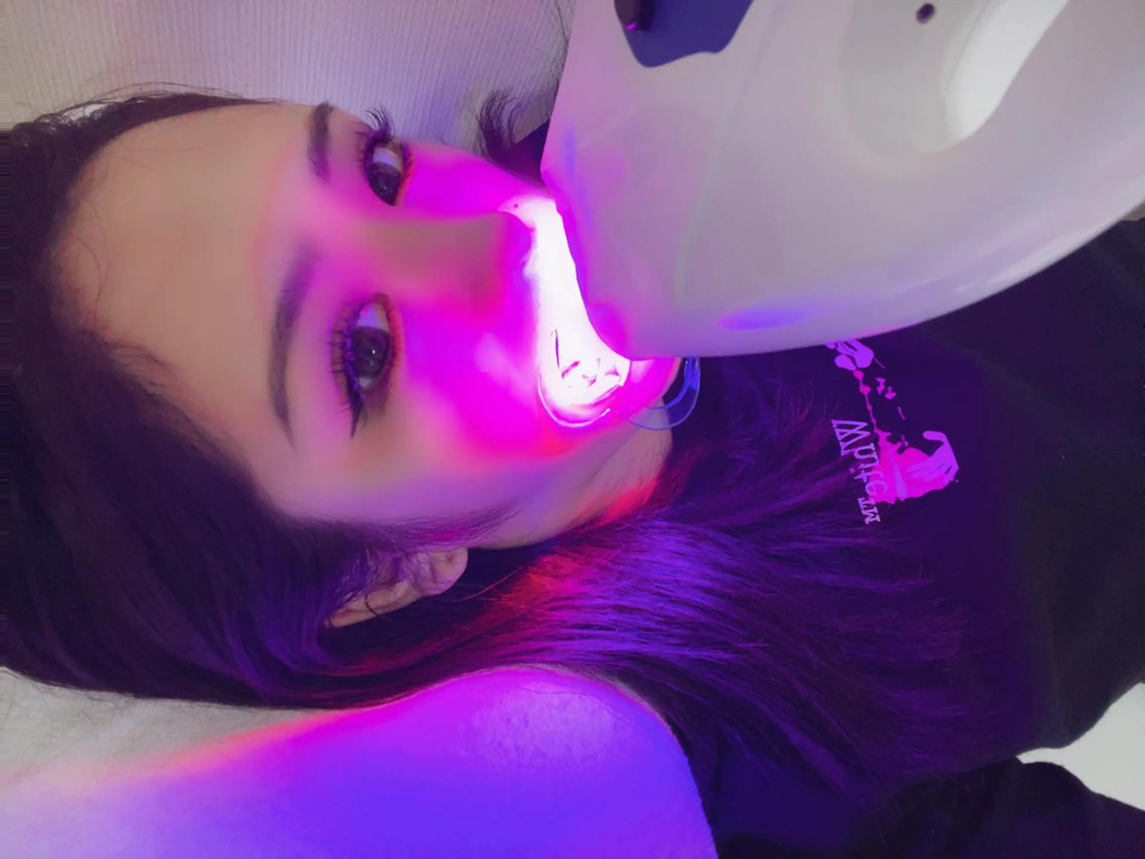 【都度払い✨】気になる着色汚れを綺麗で自然な白さに✨セルフホワイトニング10分照射×2回 の写真