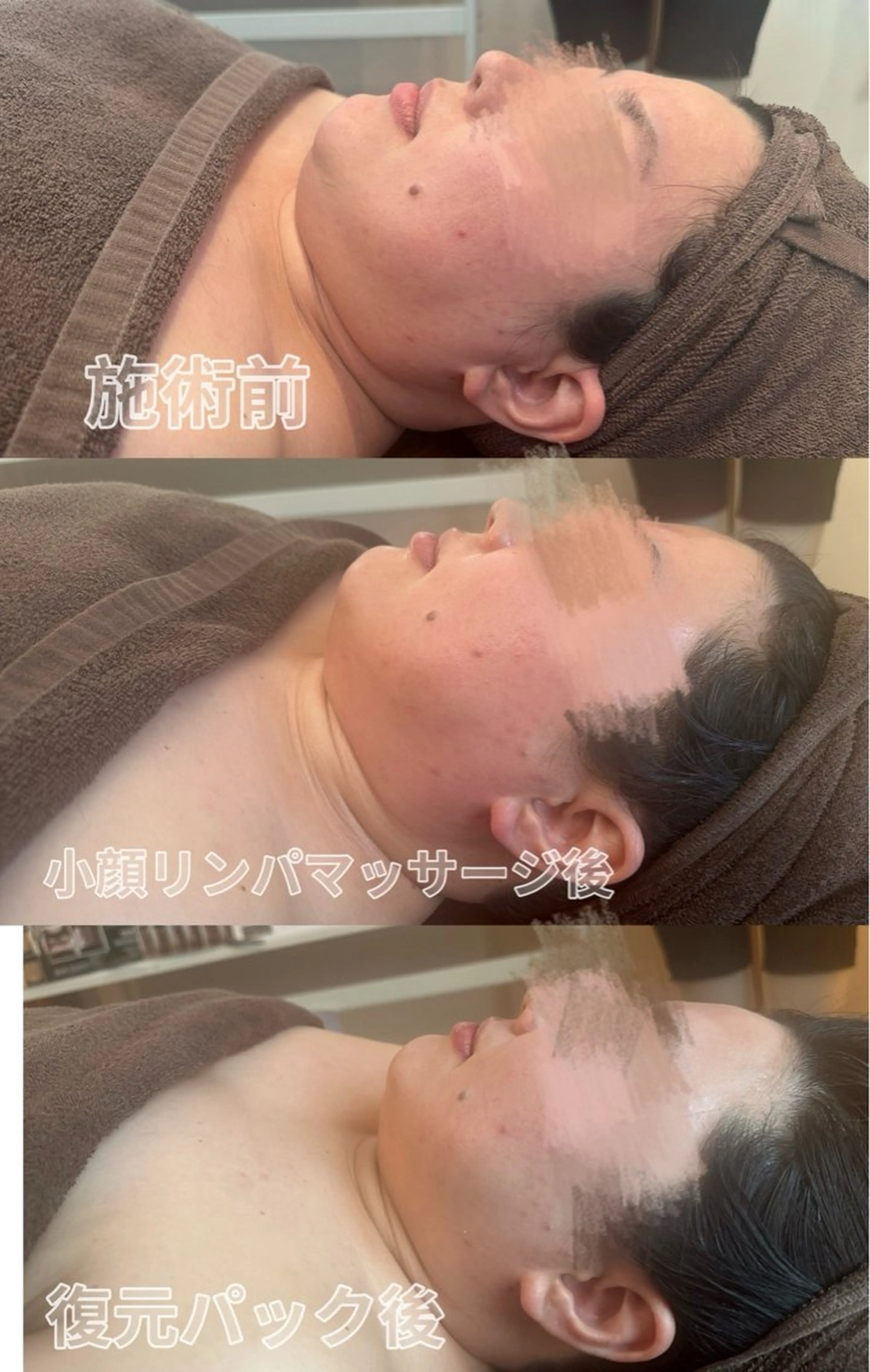 エステ リラク 浮腫|肩こり|張り 日々の疲れを解消⭐️のエステ・リラクイメージ