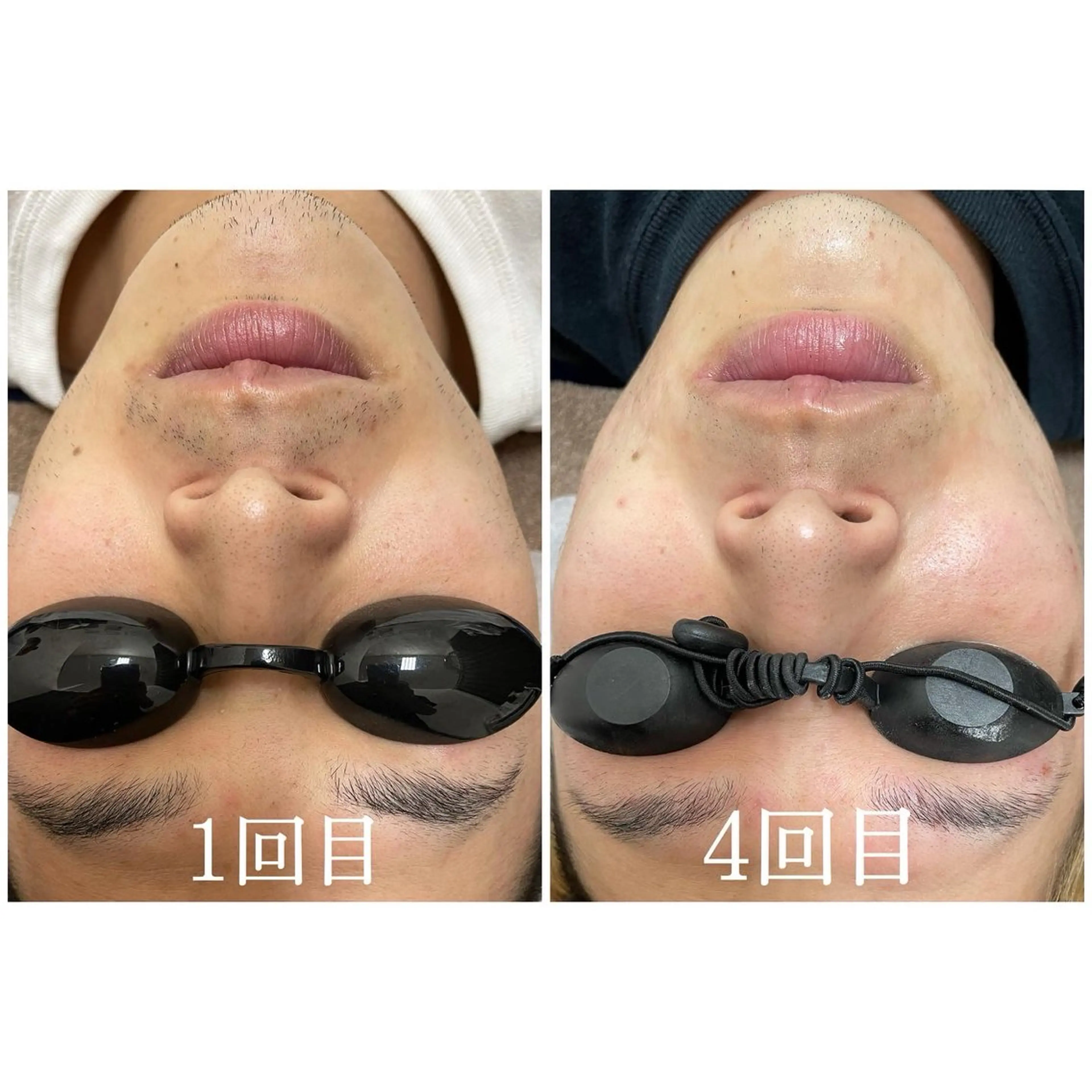 Folche所属・菊地 そらのエステ・リラクイメージ