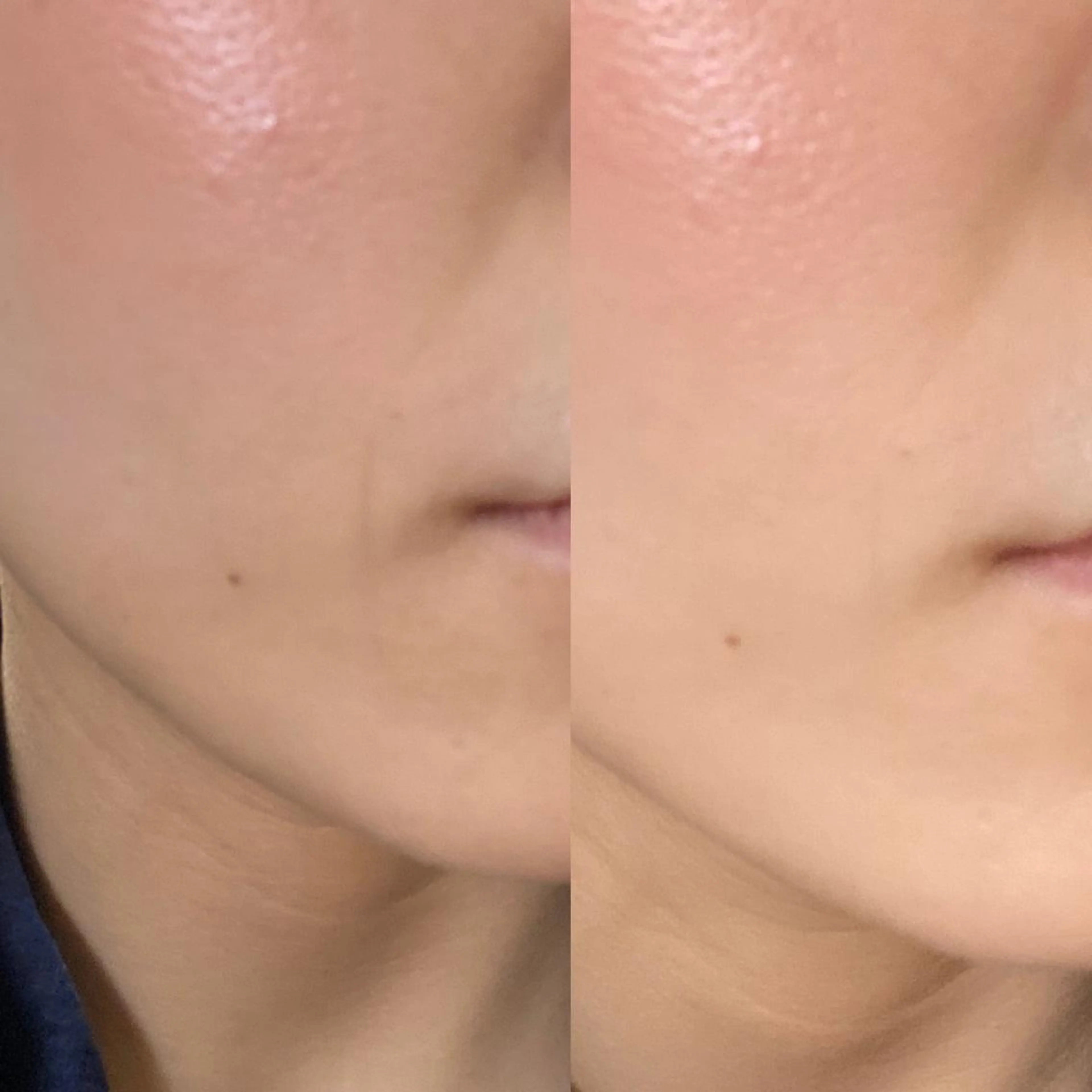 鍼灸整体院　蕾所属・美容鍼 蕾【谷町六丁目】のエステ・リラクイメージ