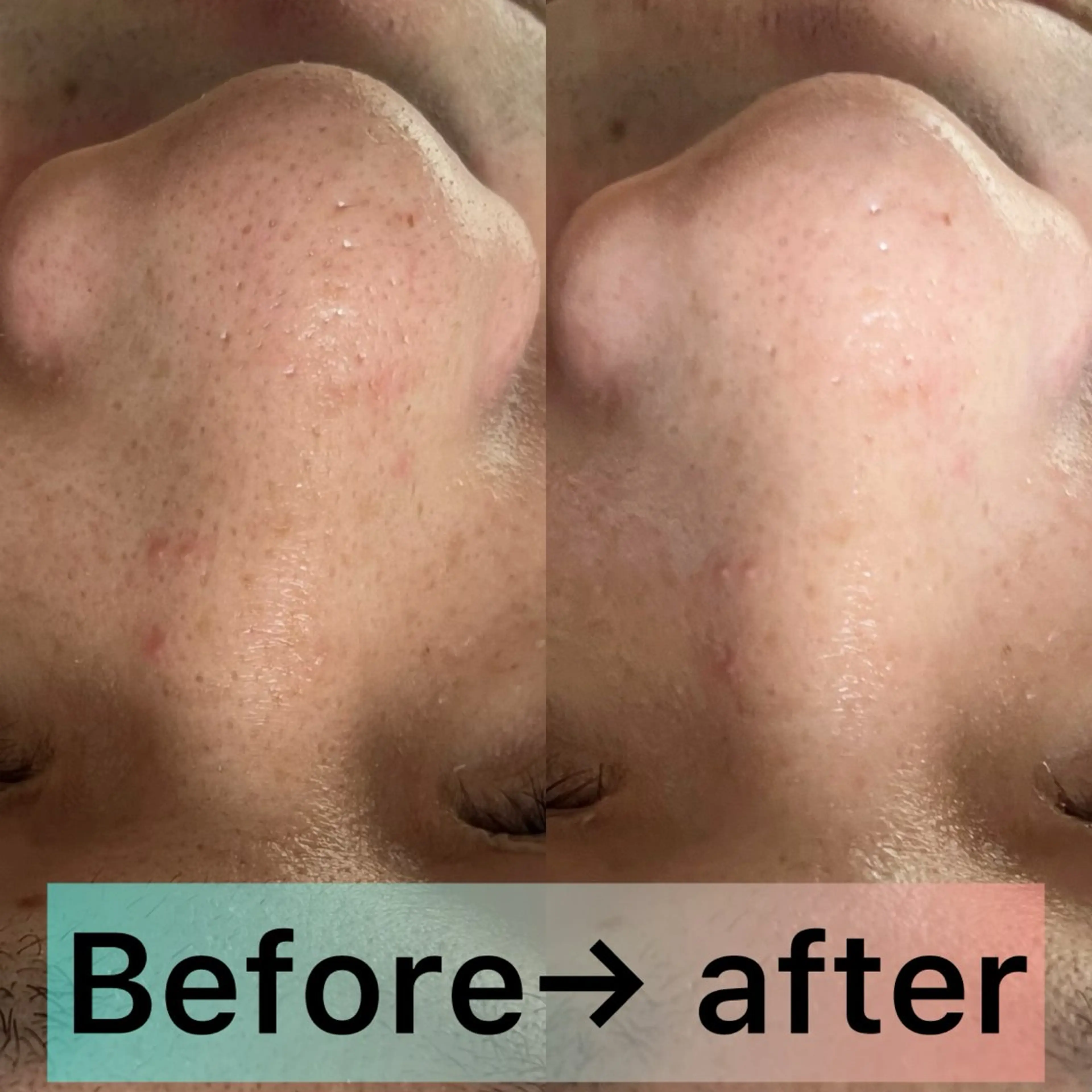 エステ La BeIIe vie所属・LaBeIIevie ラベルヴィのマツエク・マツパデザイン