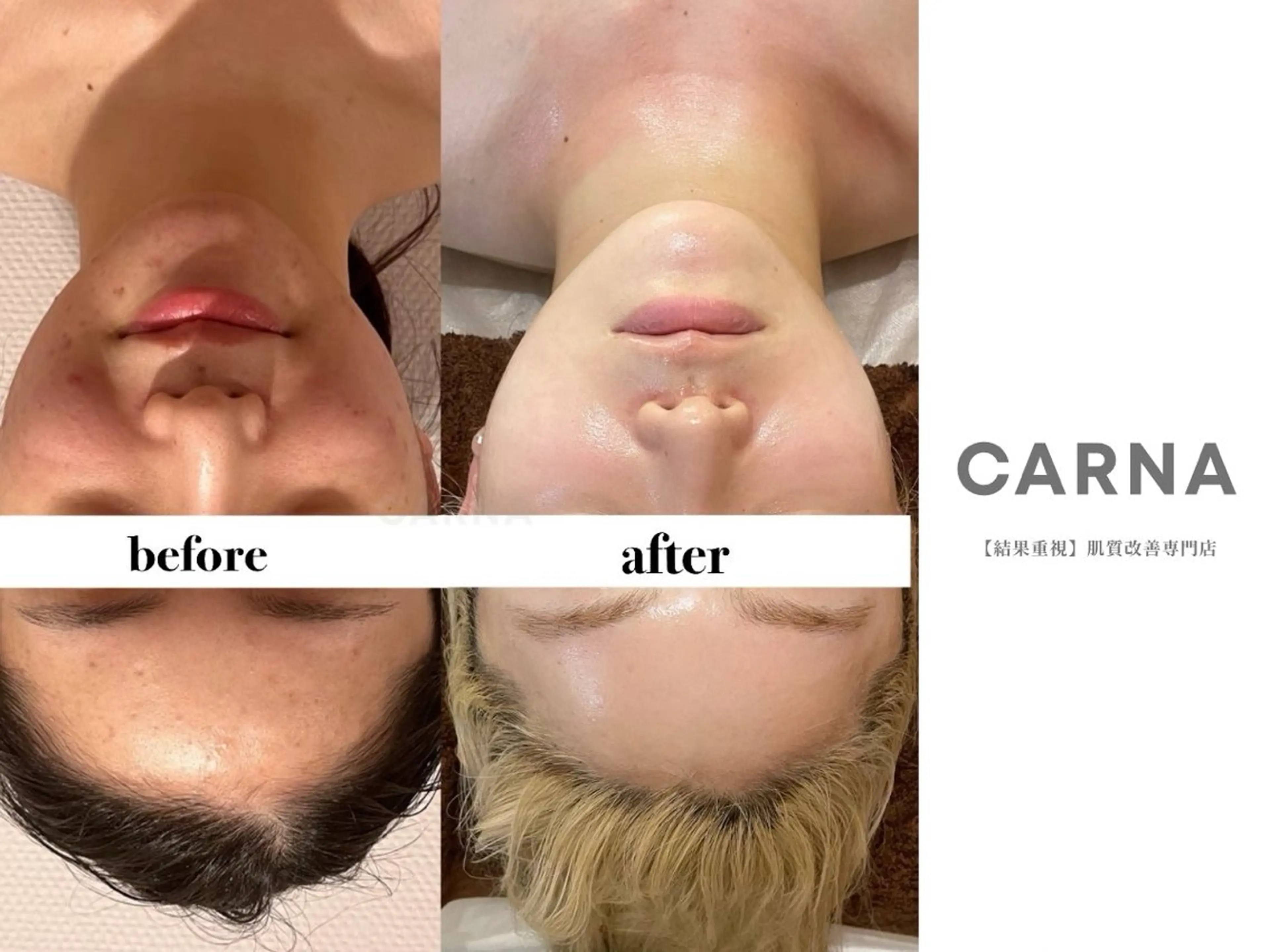 CARNA所属・【肌質改善専門店】 CARNAのエステ・リラクイメージ