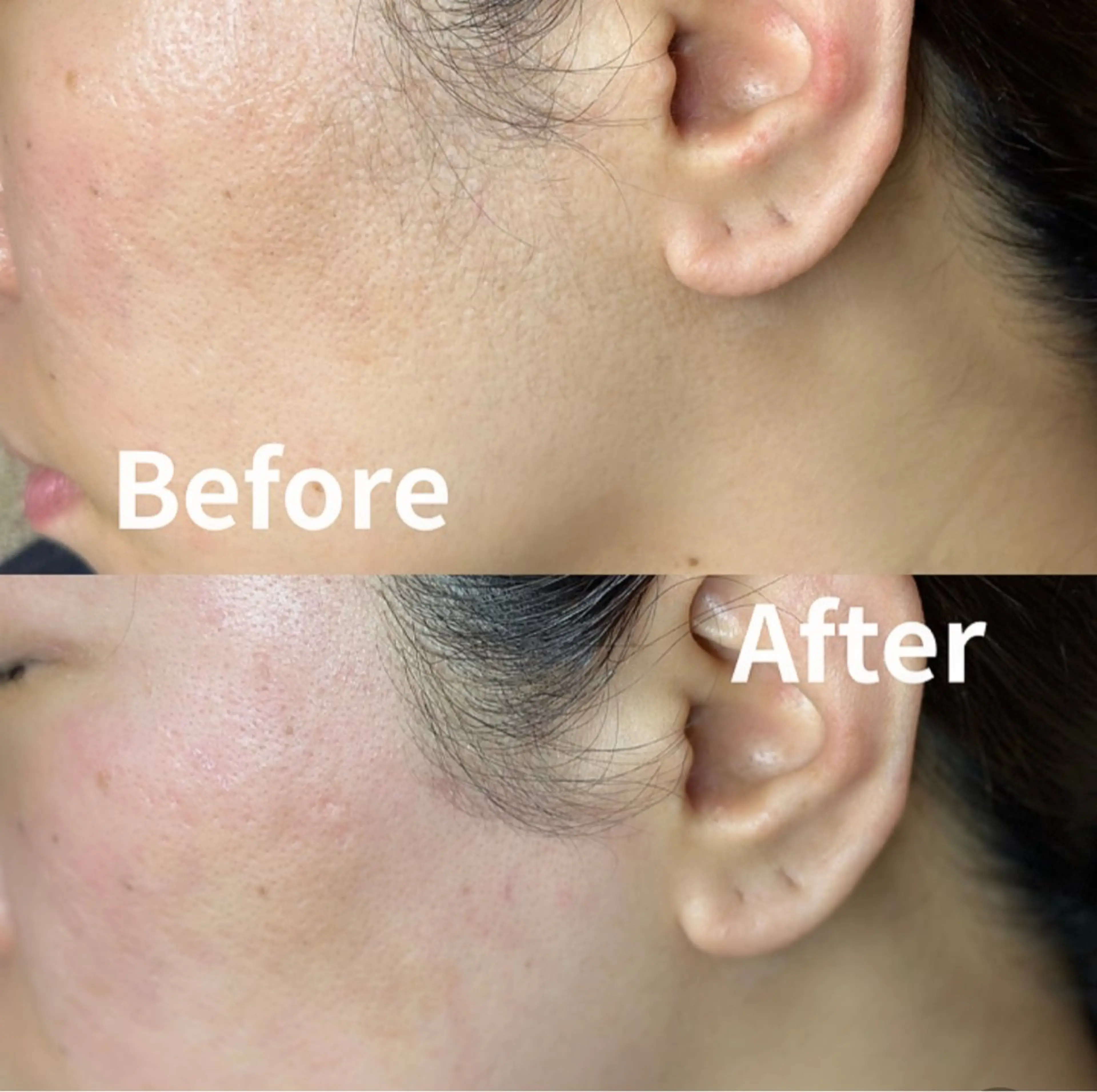 KOHOLA -ワックス脱毛専門-のエステ・リラクイメージ