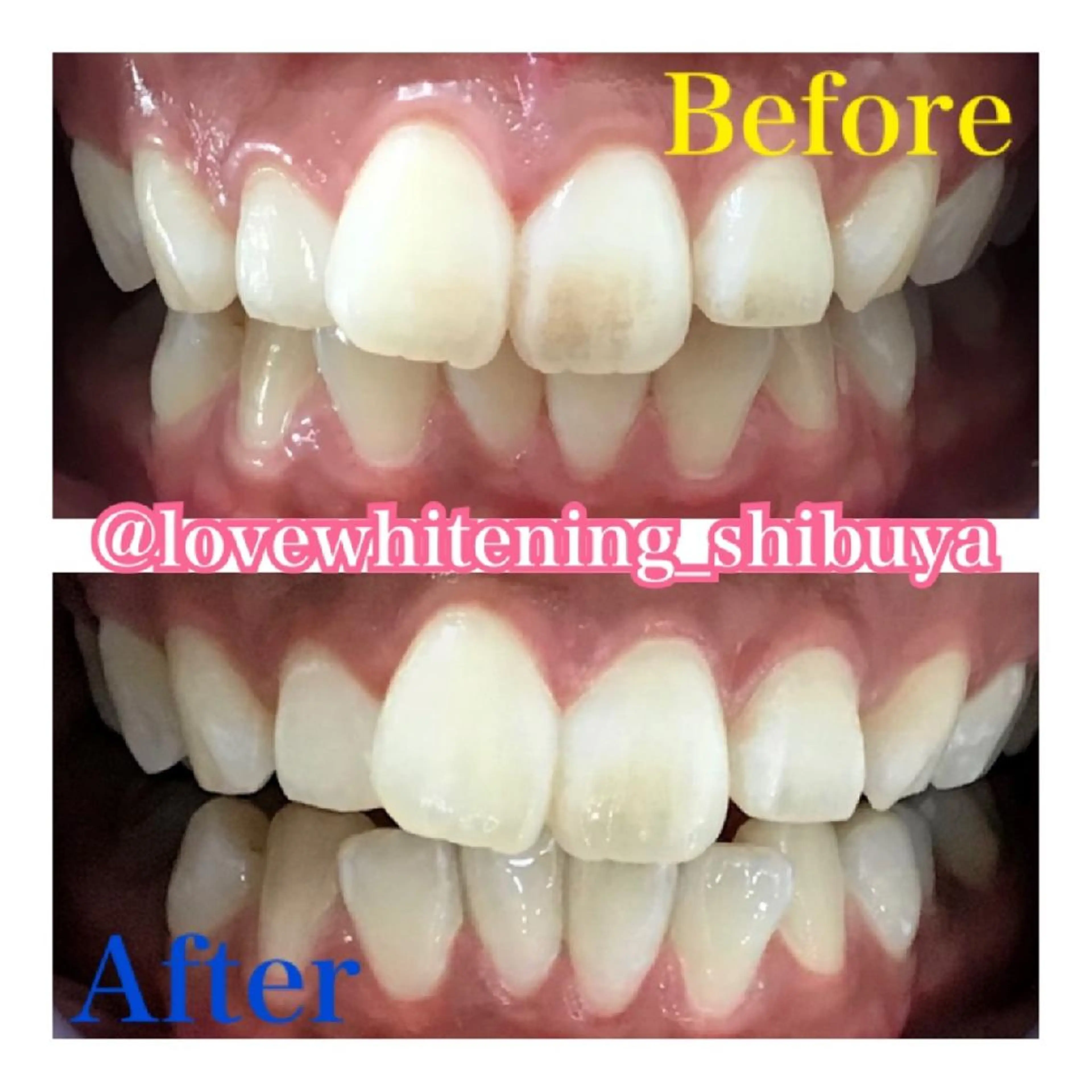 LOVE ホワイトニング渋谷のその他イメージ