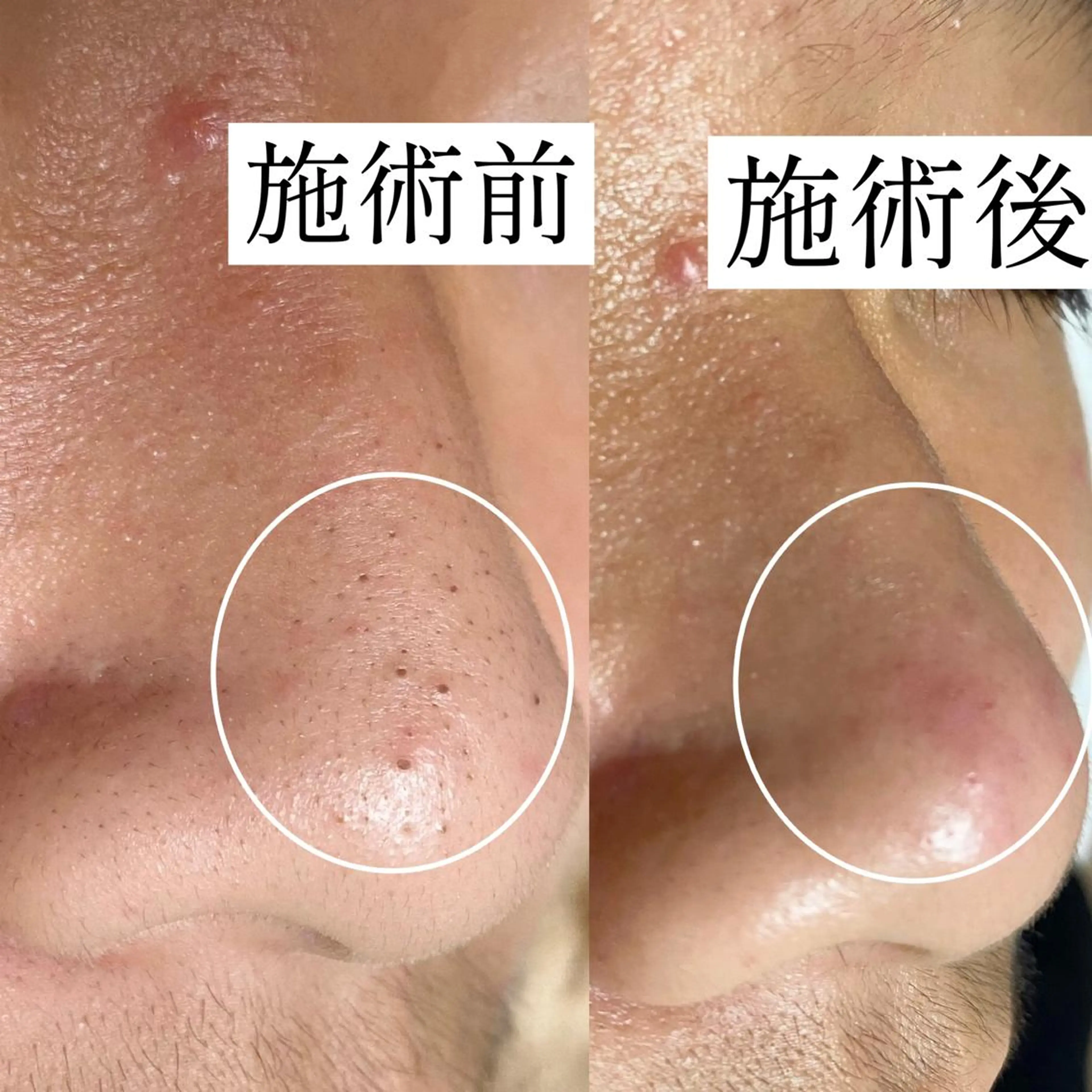 毛穴専門サロン　フルール所属・フルールFululu 自由が丘のエステ・リラクイメージ