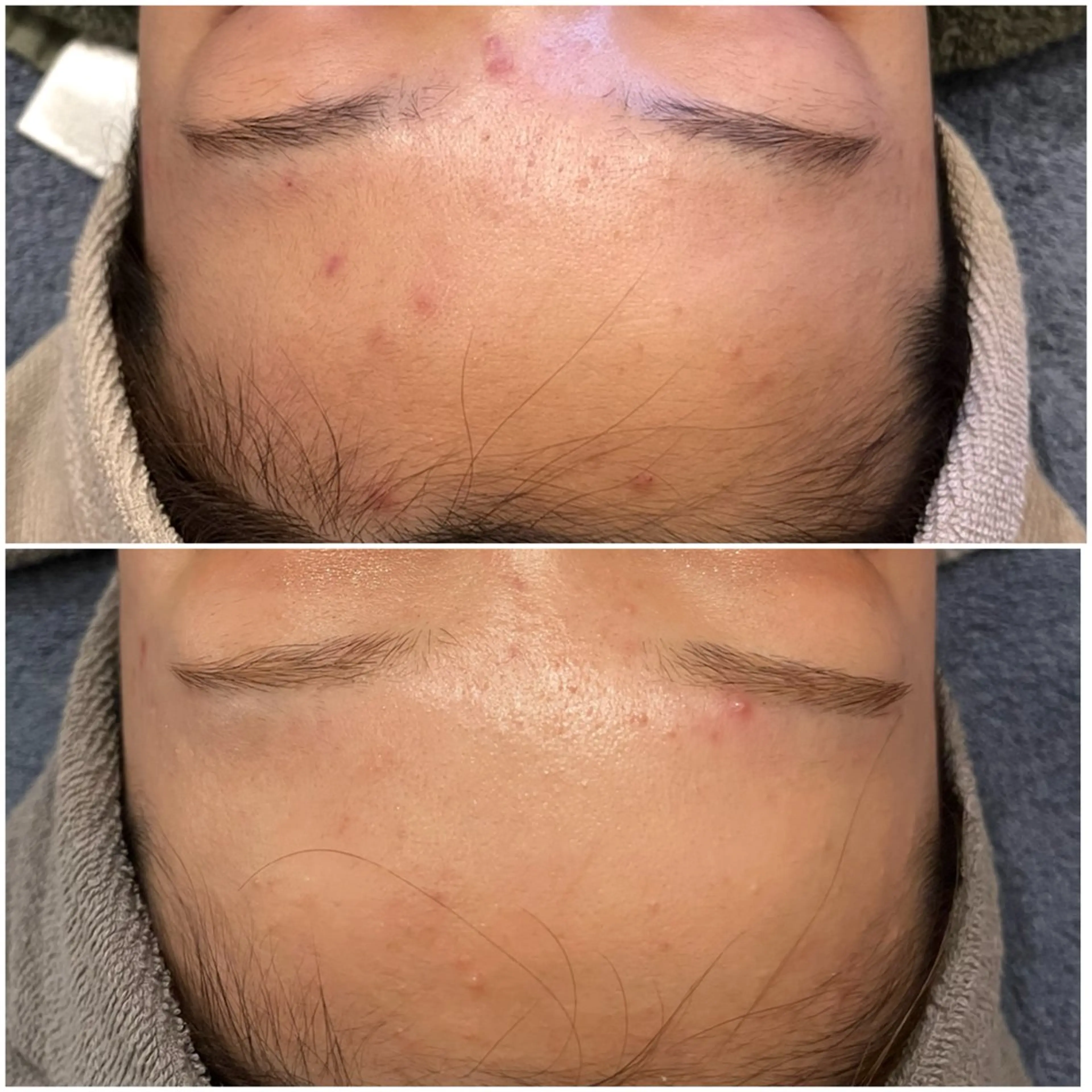 脱毛 yellow.所属・yellow💛【 脱毛&フェイシャル】のエステ・リラクイメージ