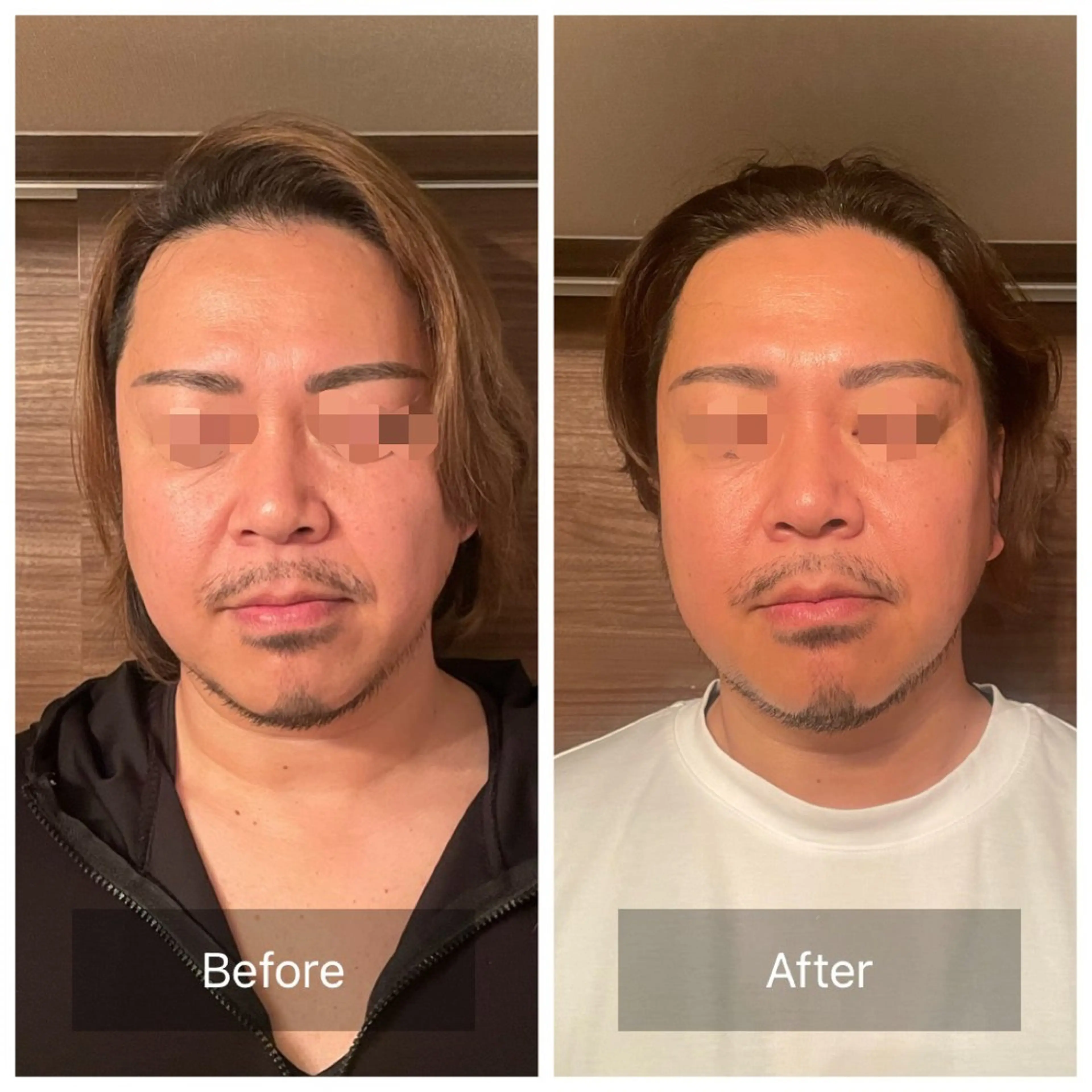 メンズ アイブロウ/脱毛/ 肌質改善🌷RINAの眉毛・アイブロウイメージ