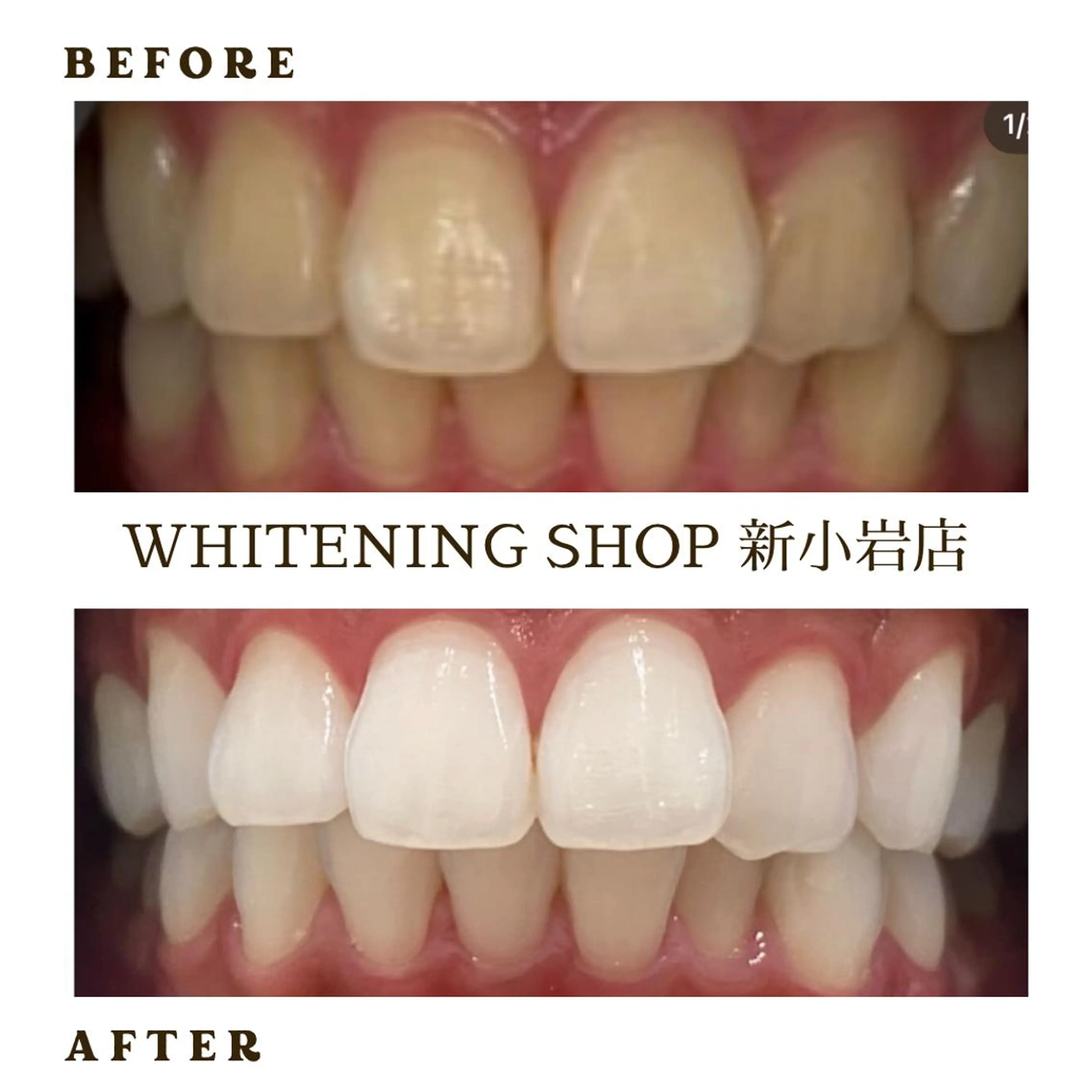 メンズ その他 ホワイトニング ショップ新小岩店のその他イメージ