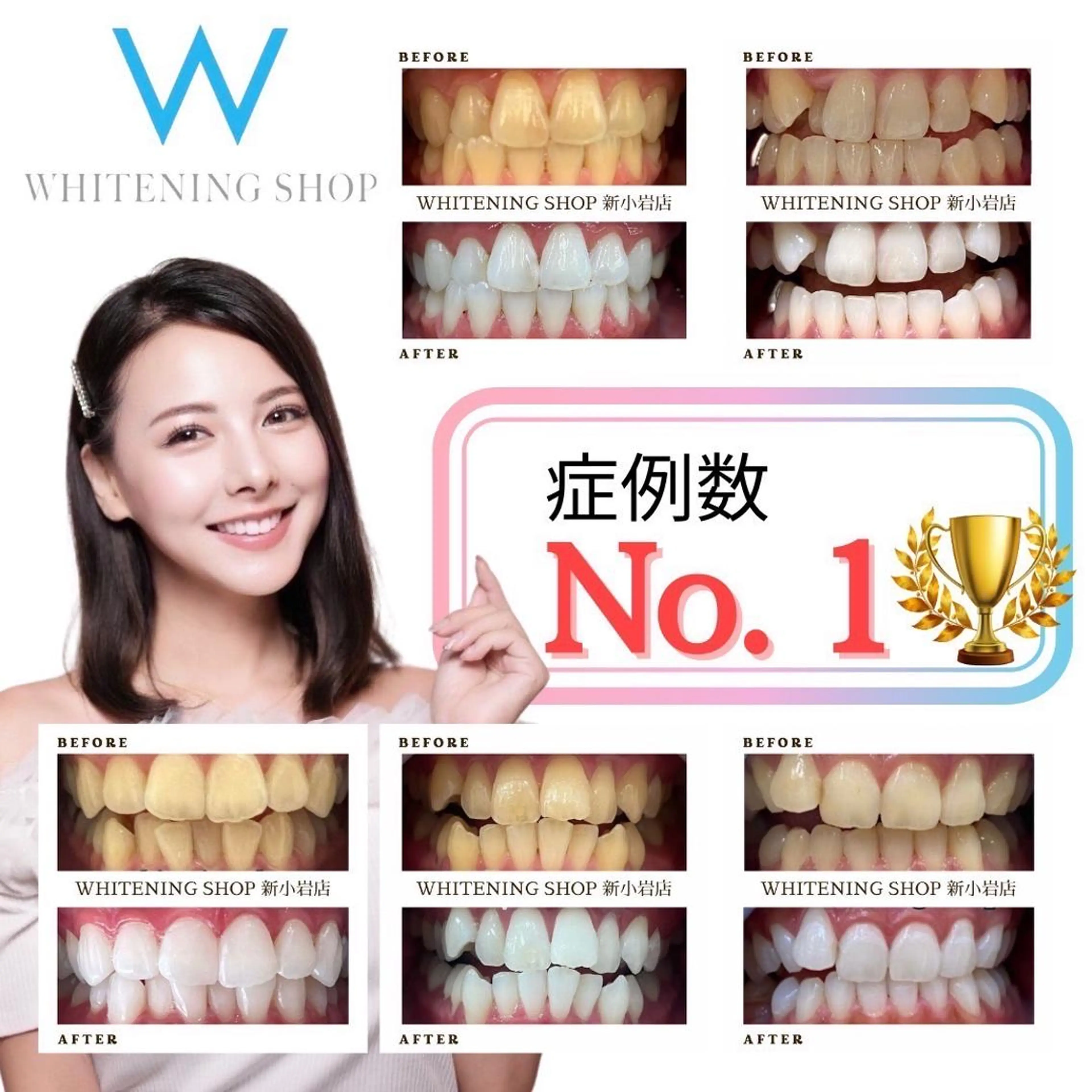 メンズ エステ ホワイトニング ショップ千葉店のその他イメージ