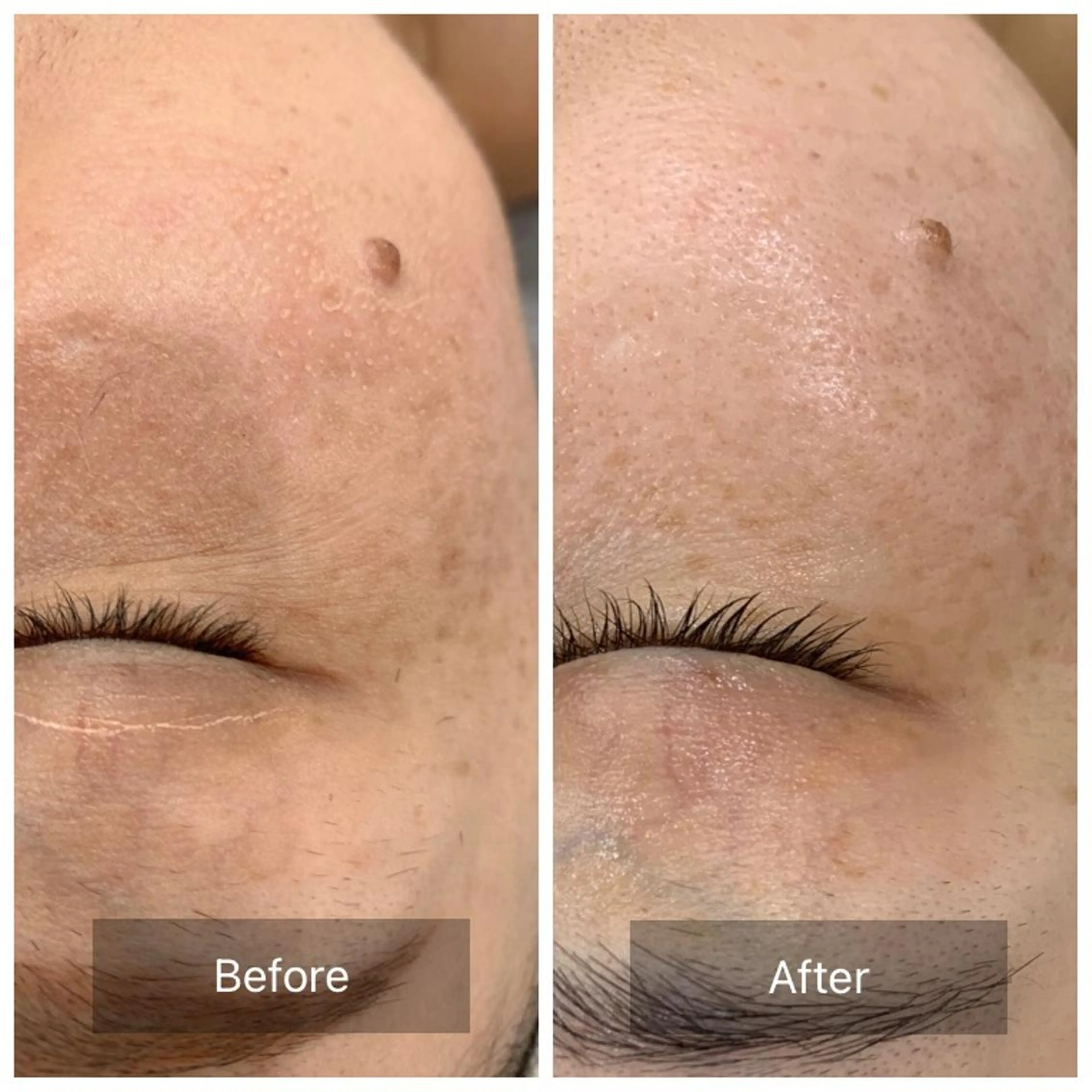 すっぴんたまご肌 平木さやかのエステ・リラクイメージ