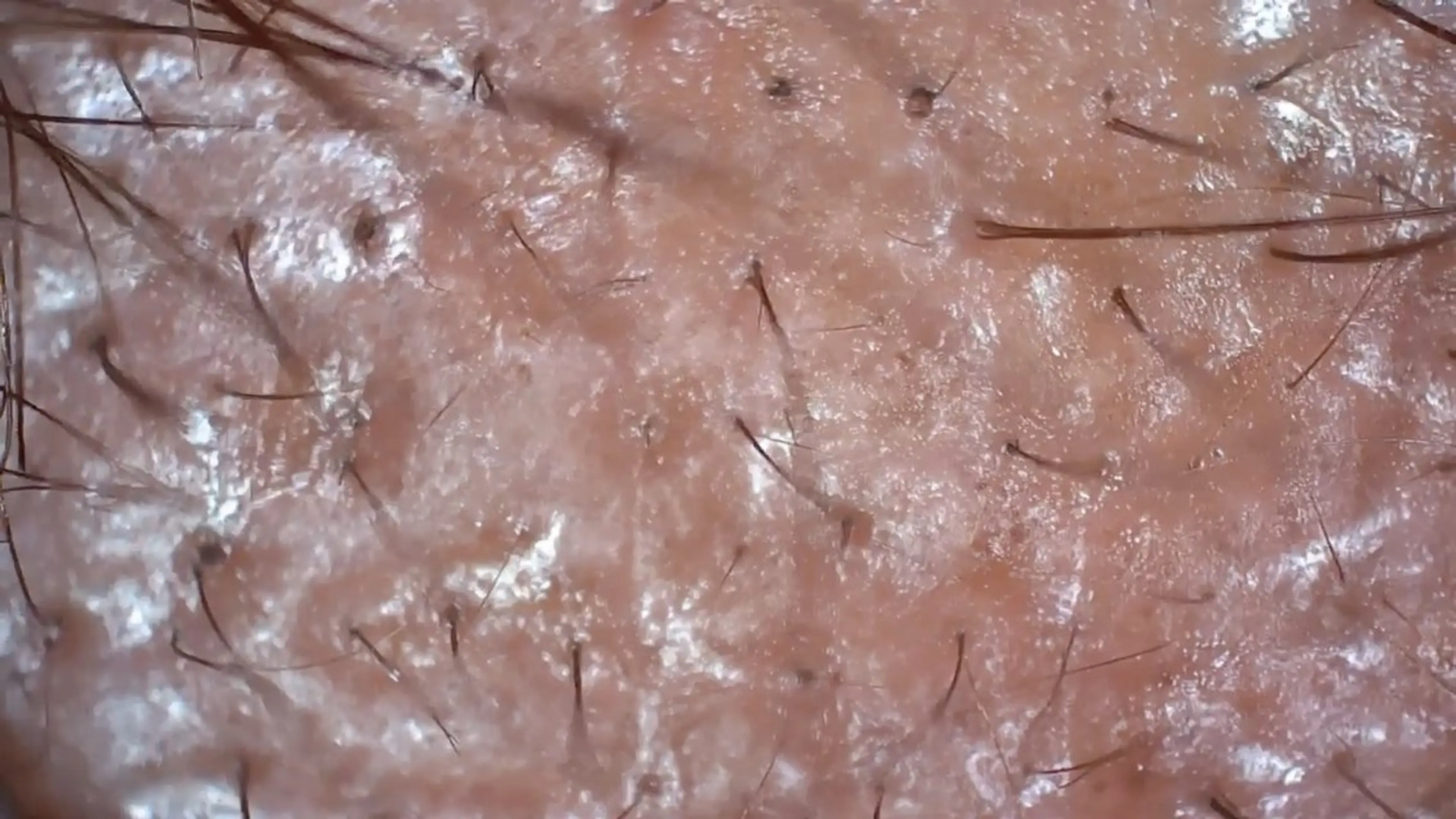 ヘッドスパ 五十嵐 蓮のその他イメージ