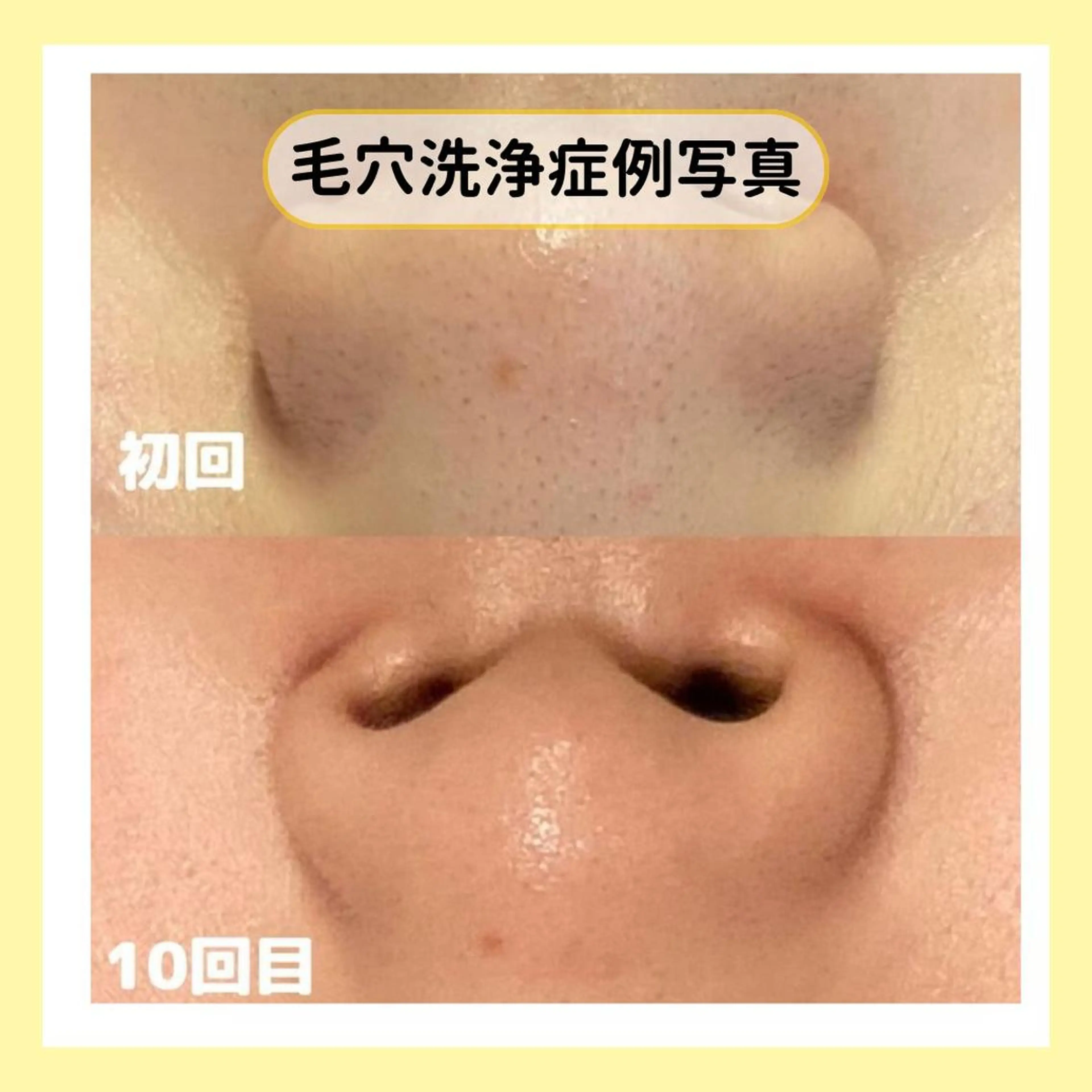 金山/脱毛/美肌 ULULUのエステ・リラクイメージ