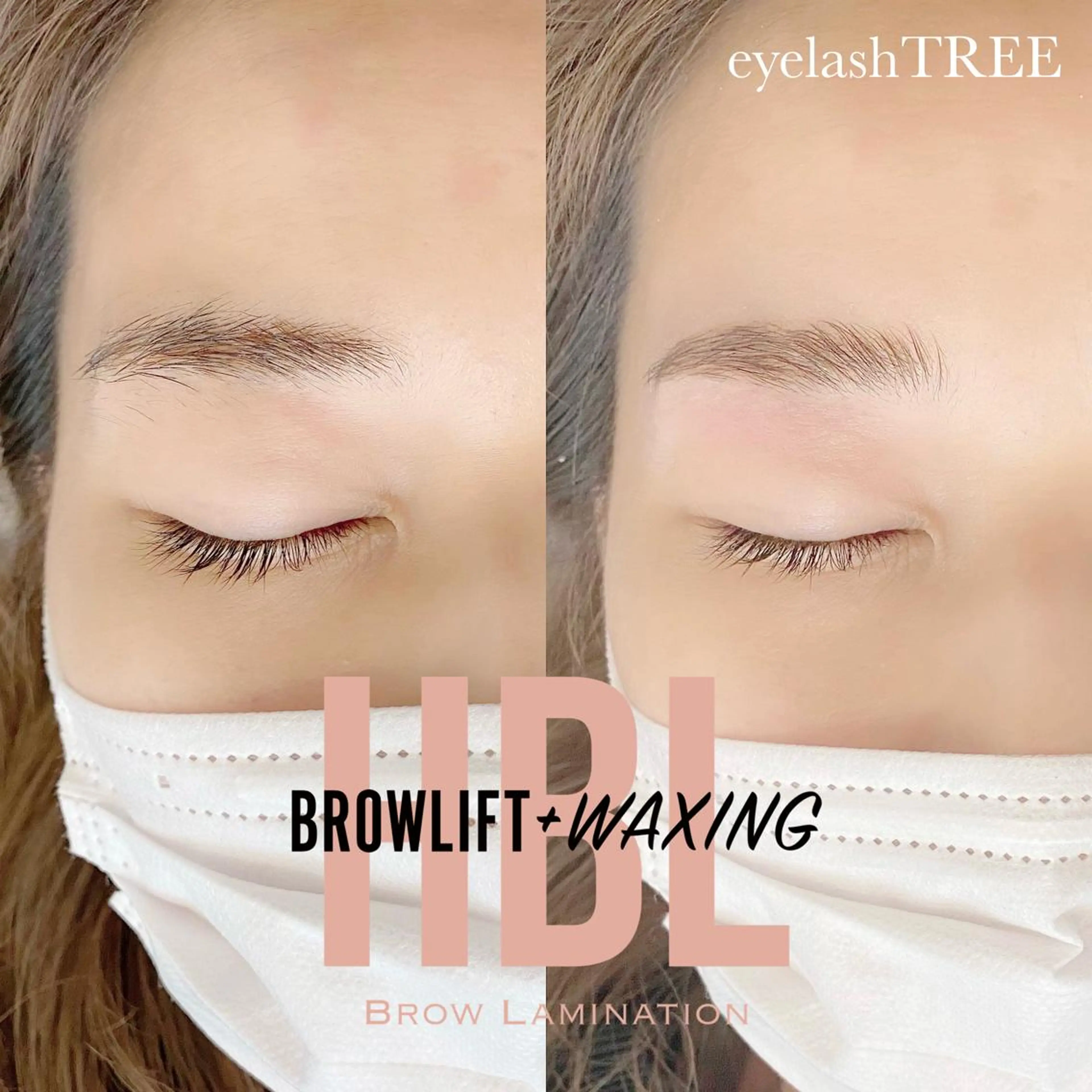 マツエク・マツパ まつげ、毛穴 TREEのエステ・リラクイメージ