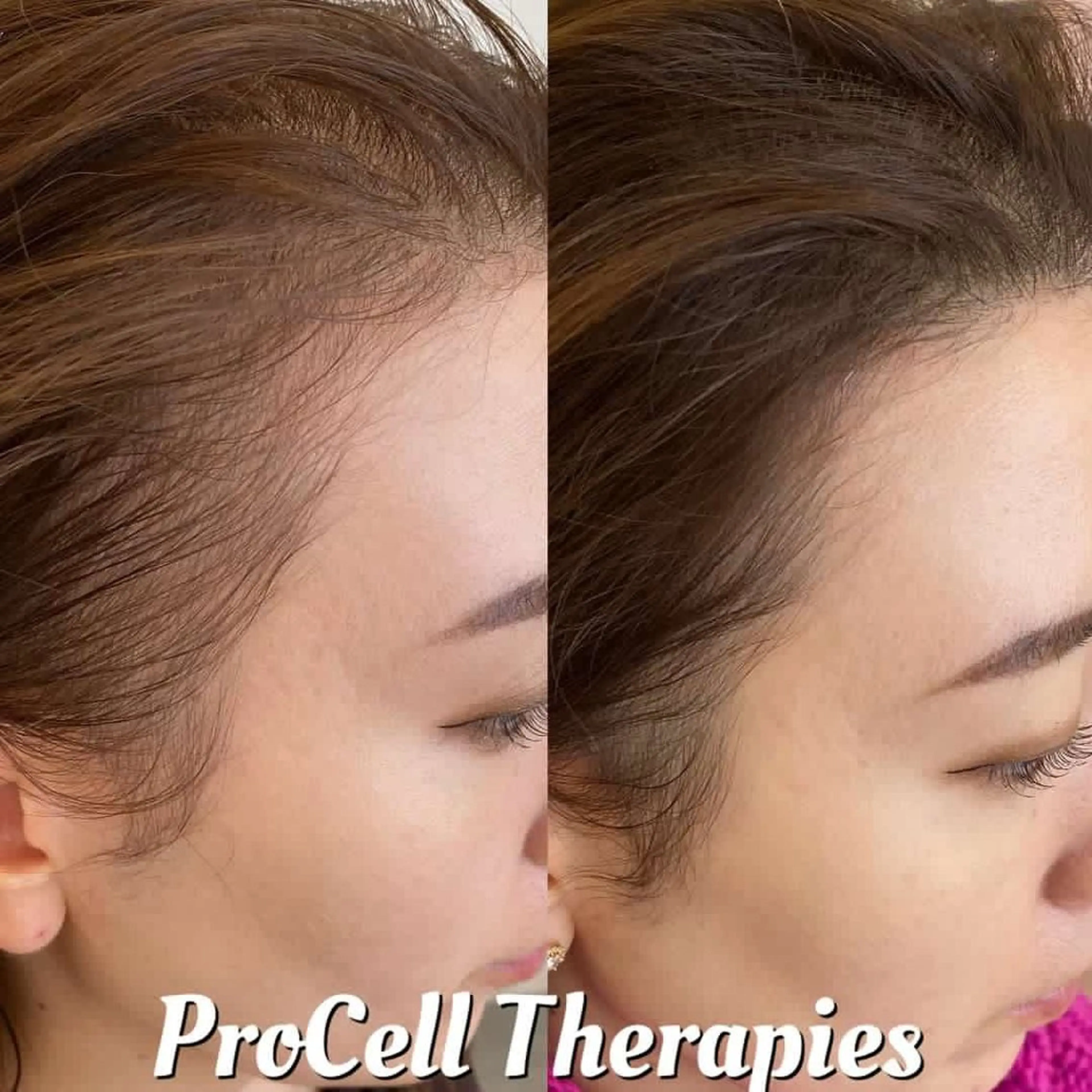 Blooming所属・LOUISE. ／肌質・頭皮のエステ・リラクイメージ