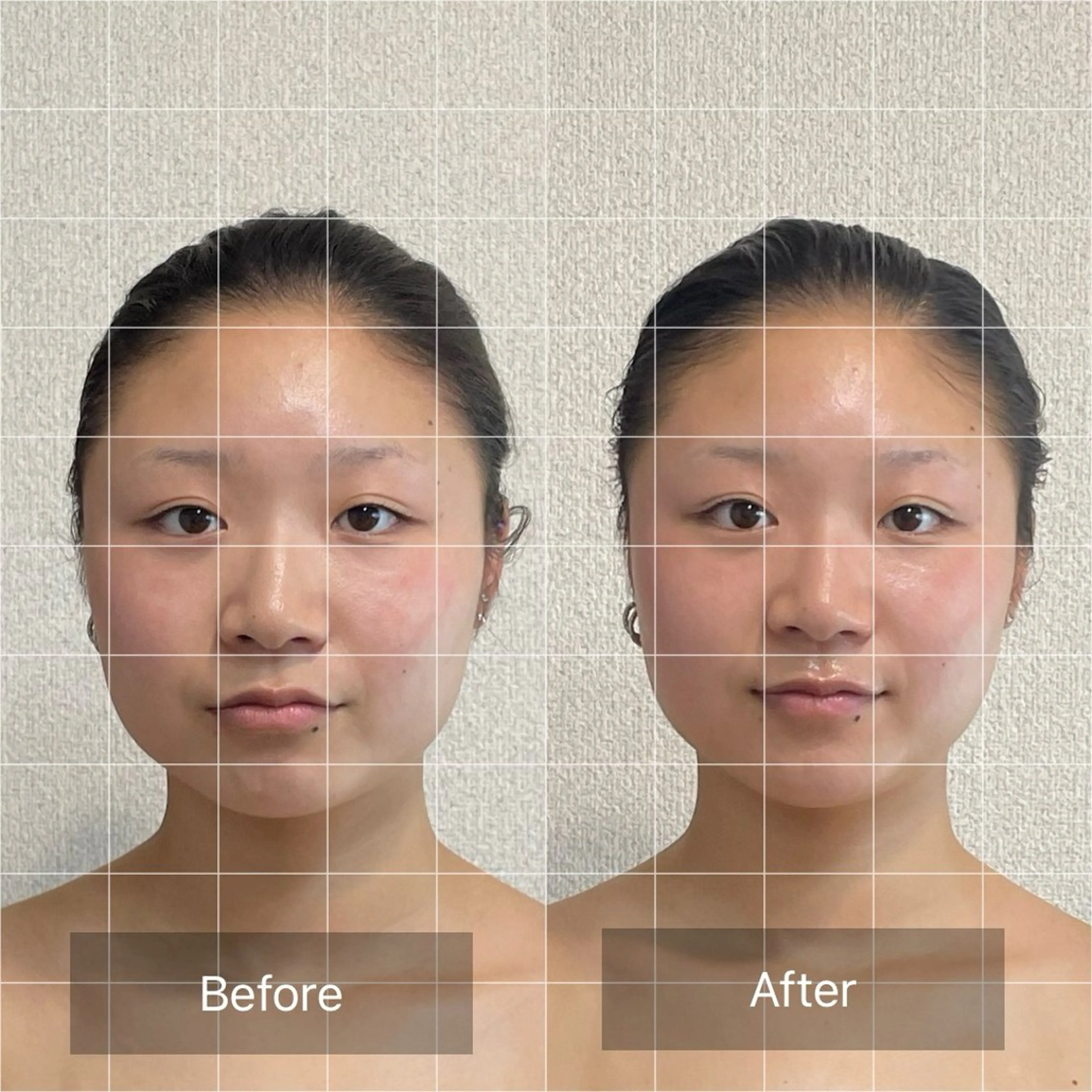 極-kiwami- 極上快眠小顔ヘッドスパトリートメントの写真