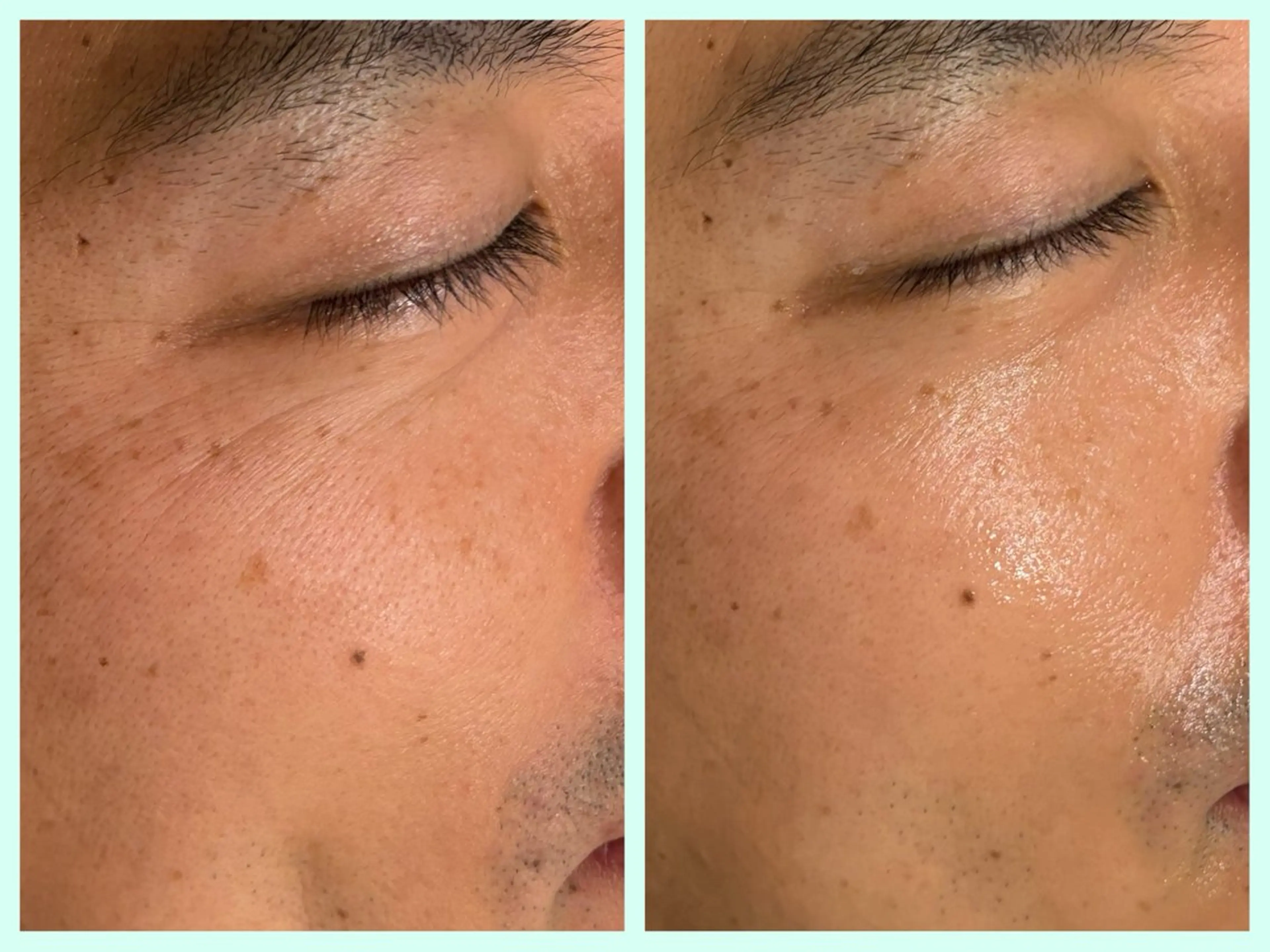 メンズ エステ ☆痩身/小顔☆ コルギのエステ・リラクイメージ