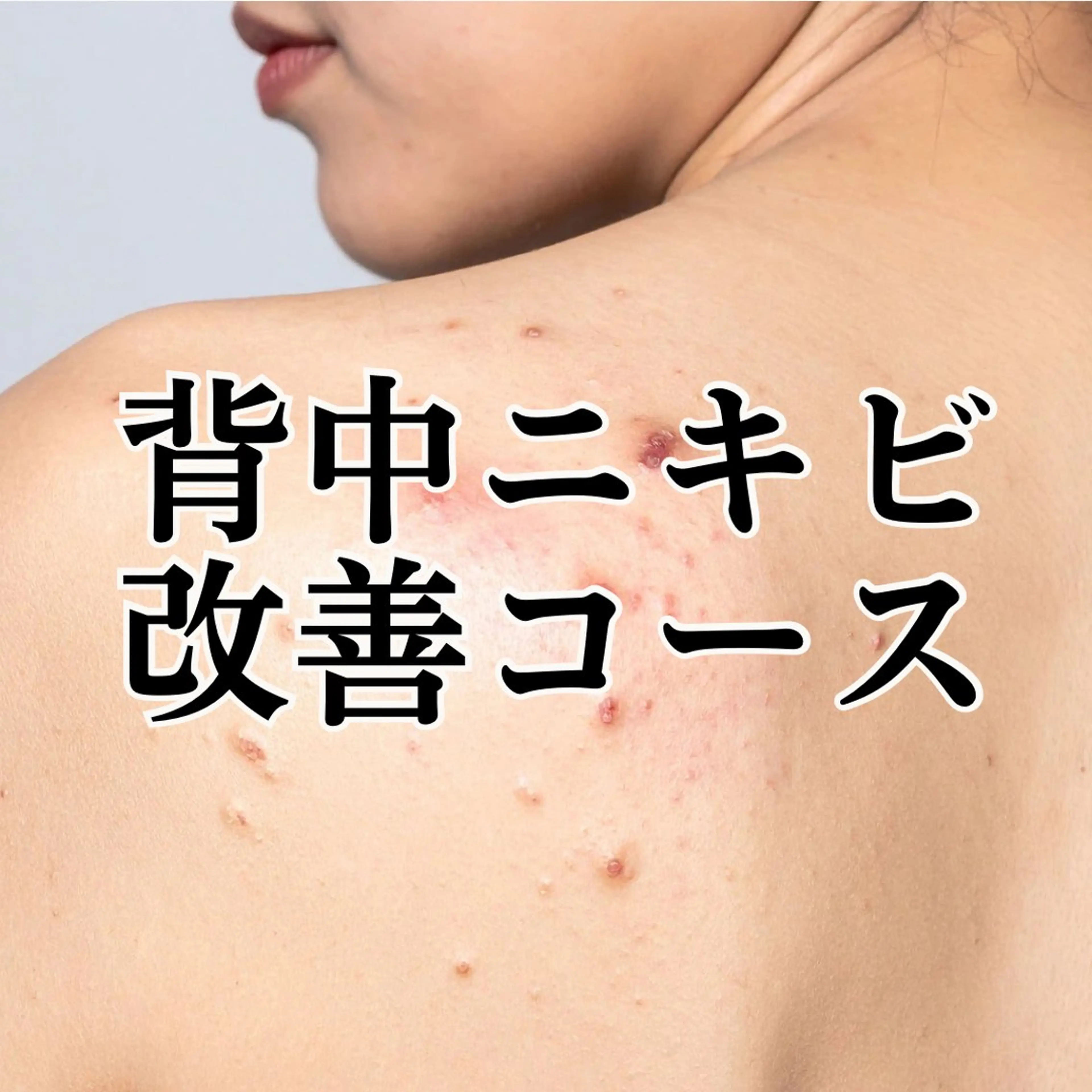 エステ シミ毛穴|眉Wax THE  flowのエステ・リラクイメージ