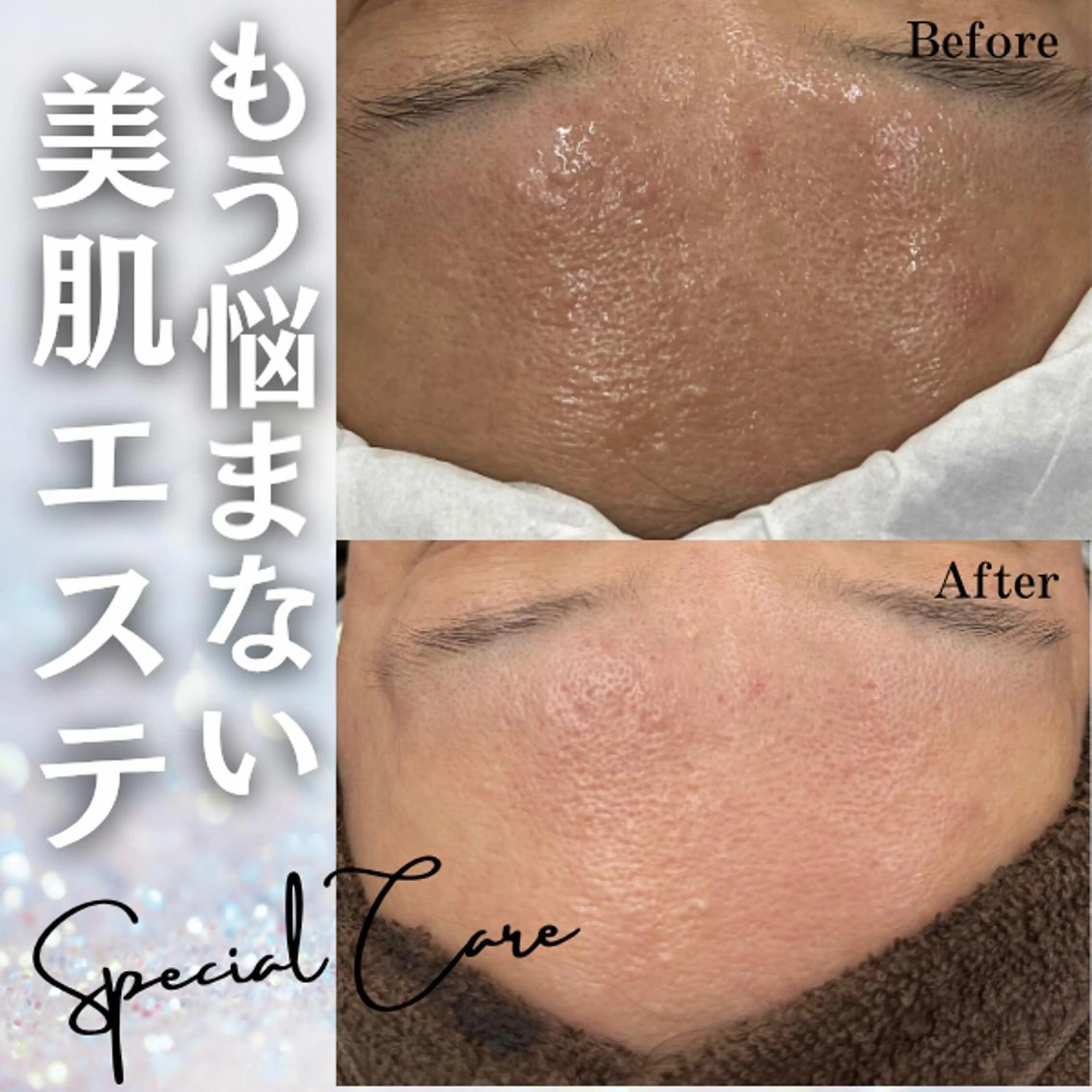 毛穴専門店Bebe 蘭のエステ・リラクイメージ