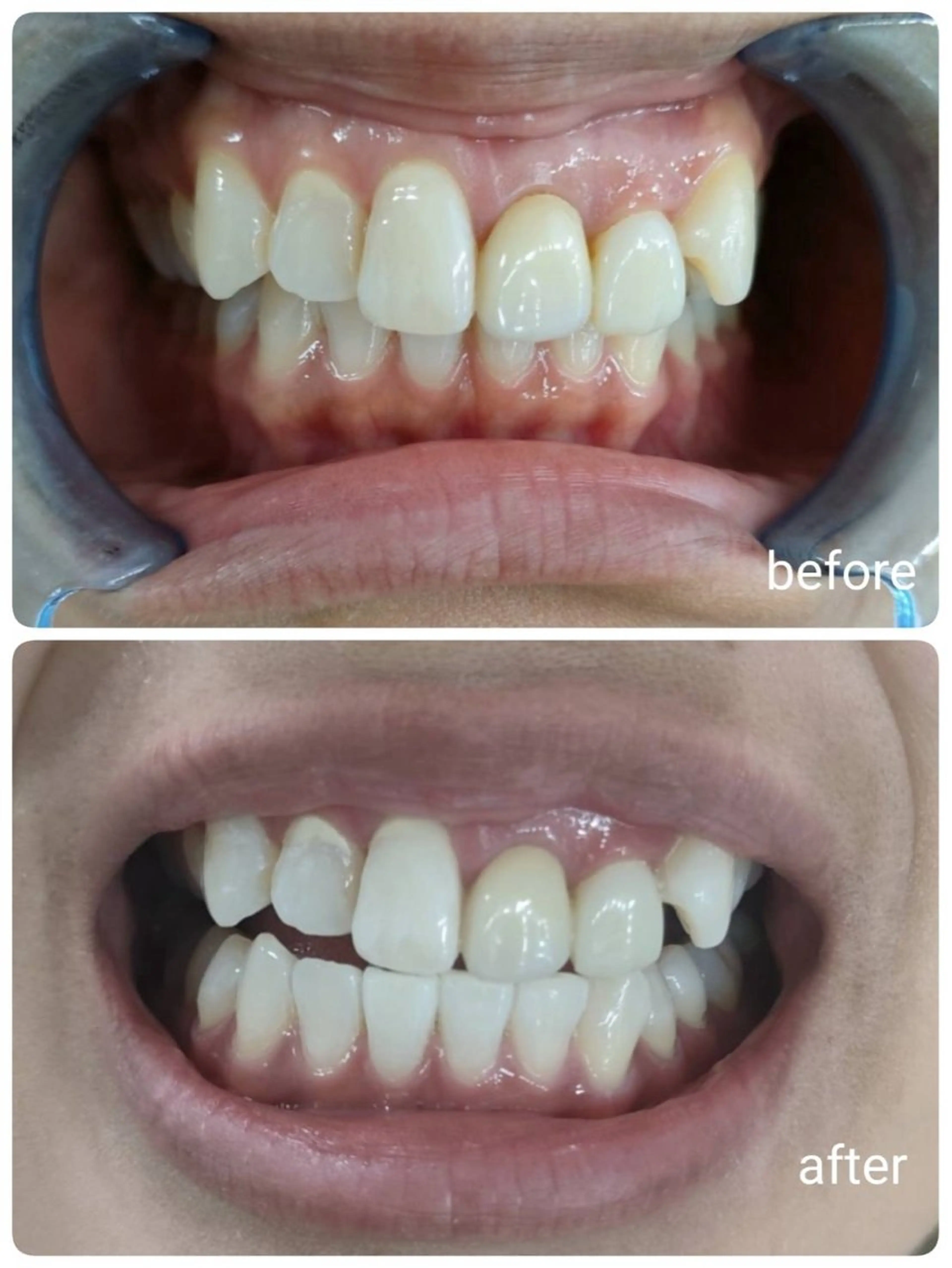 その他 セルフホワイトニングサロン　エクシアホワイト西尾店所属・エクシアホワイト西尾 堀内恵のその他イメージ