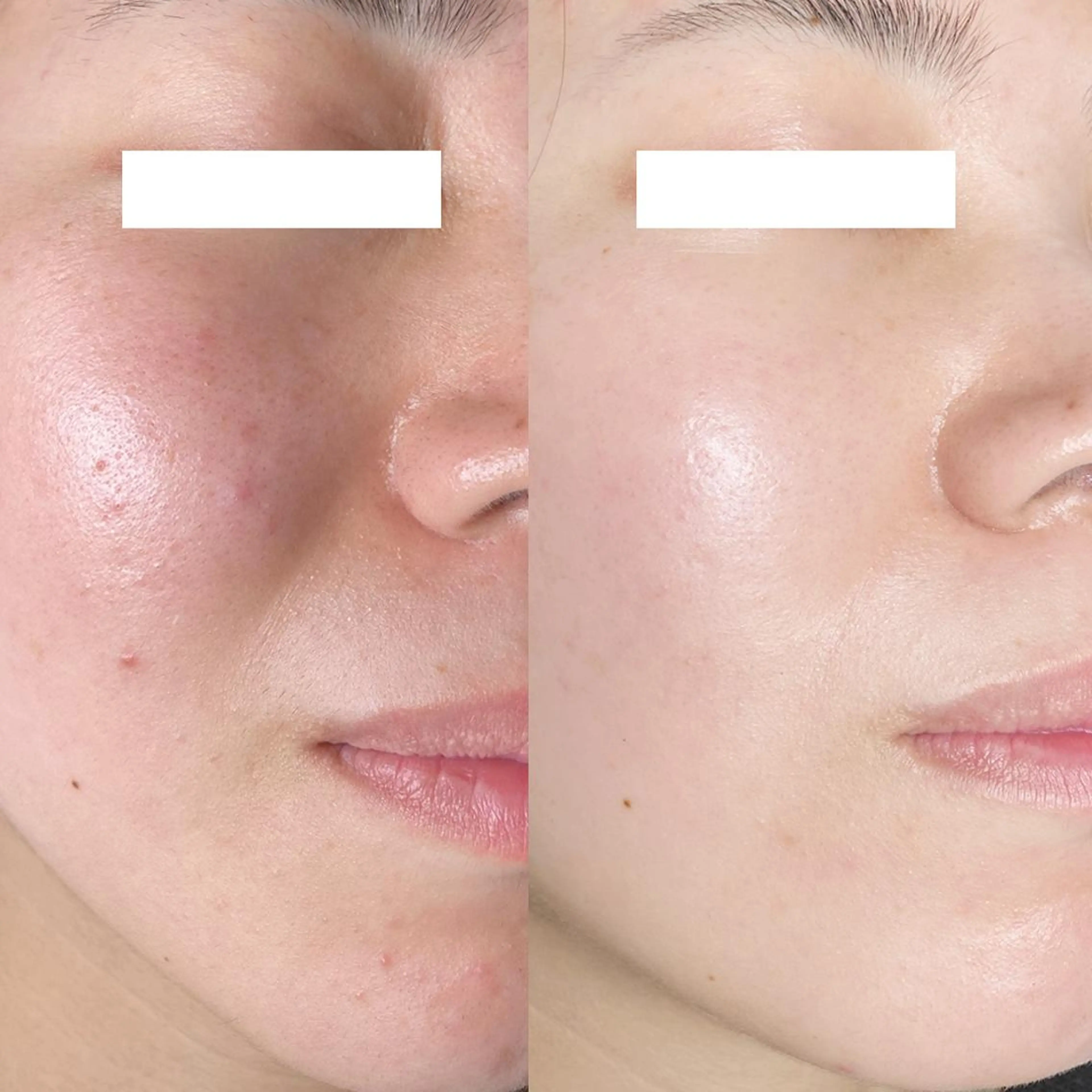 Monreve所属・美人スイッチdiet スーパージェクションのその他イメージ