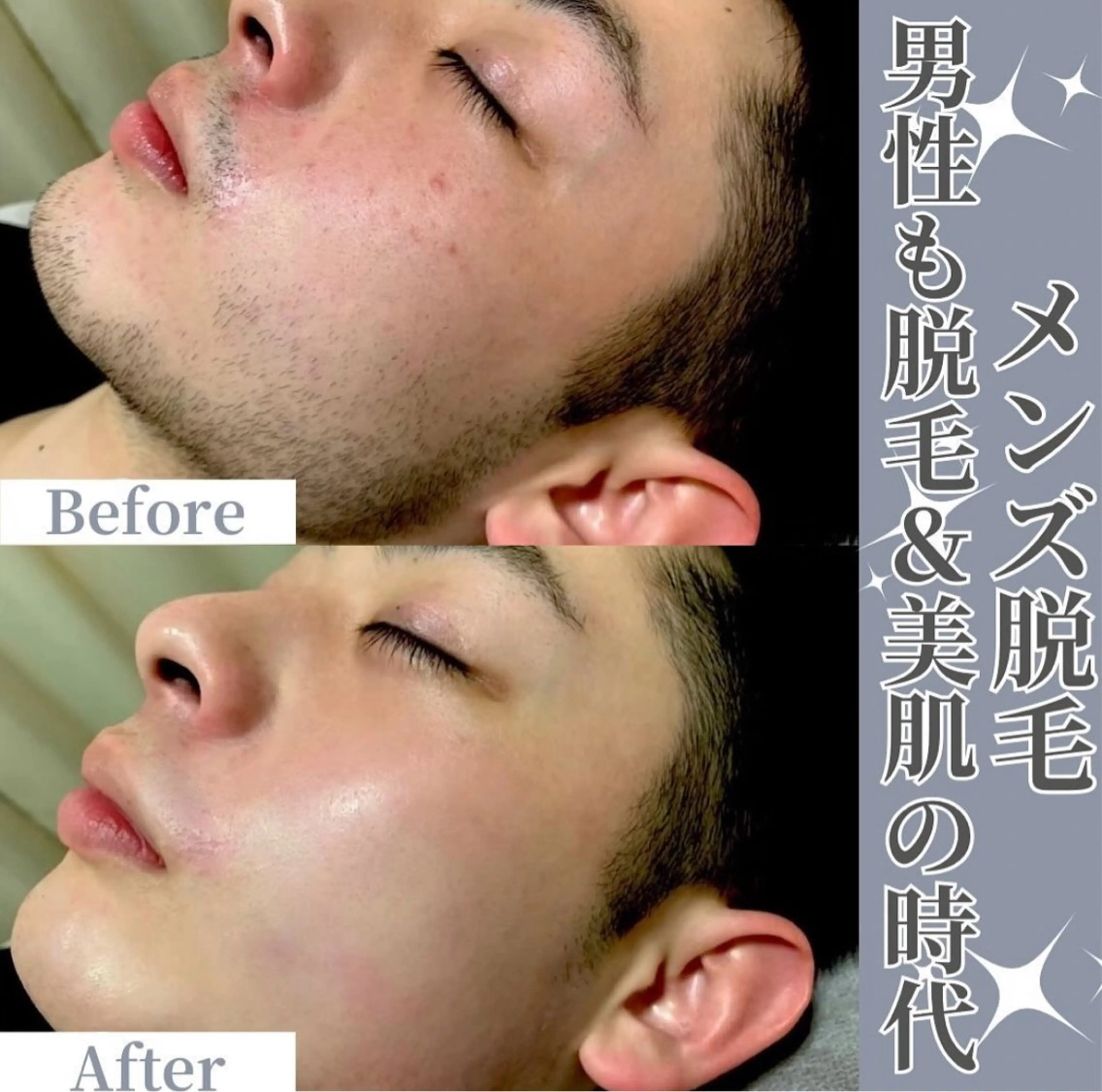 脱毛サロンALGO所属・美肌脱毛/ワックス ALGO高槻店のエステ・リラクイメージ