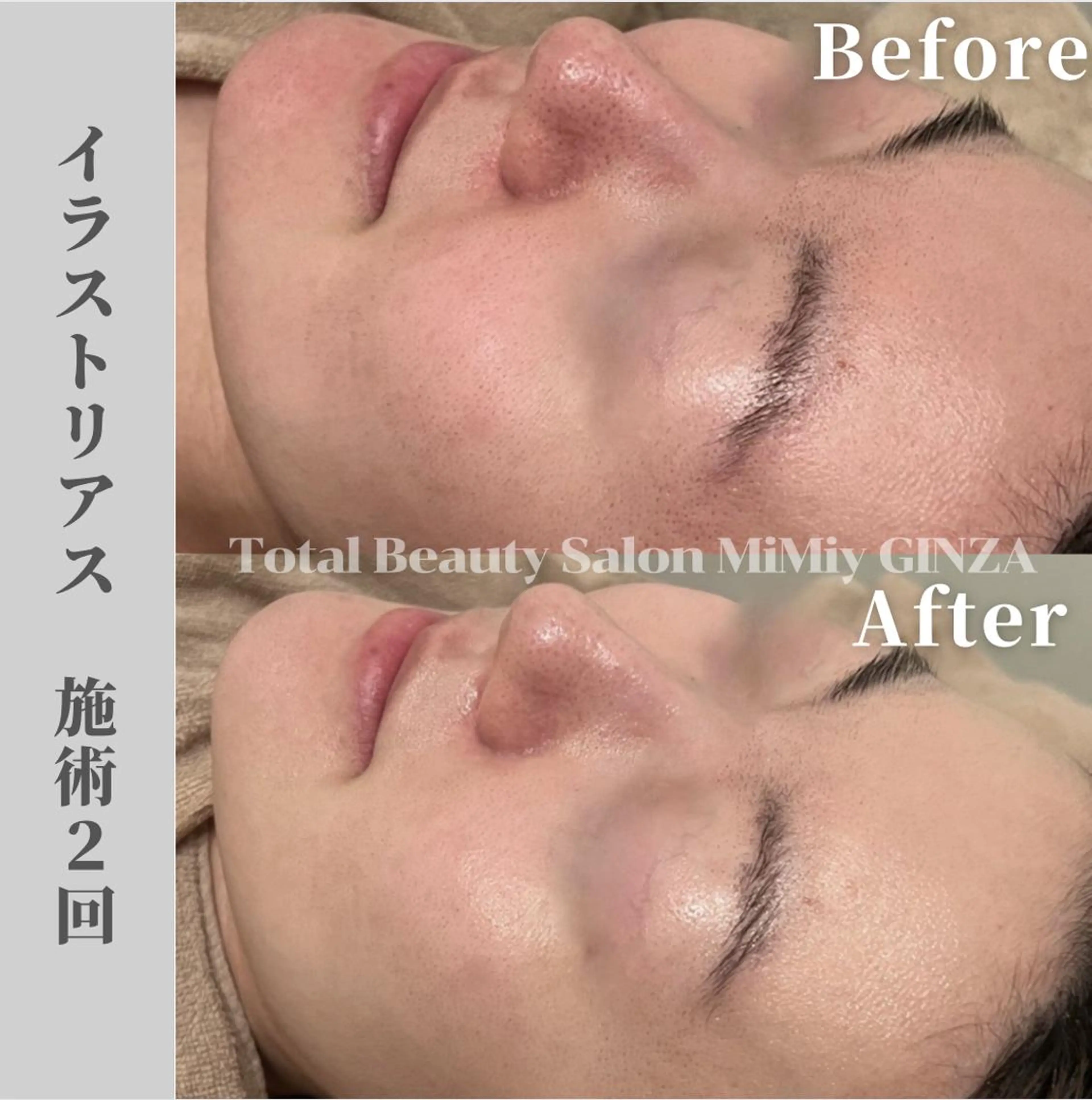 エステ MiMiy 銀座店のエステ・リラクイメージ