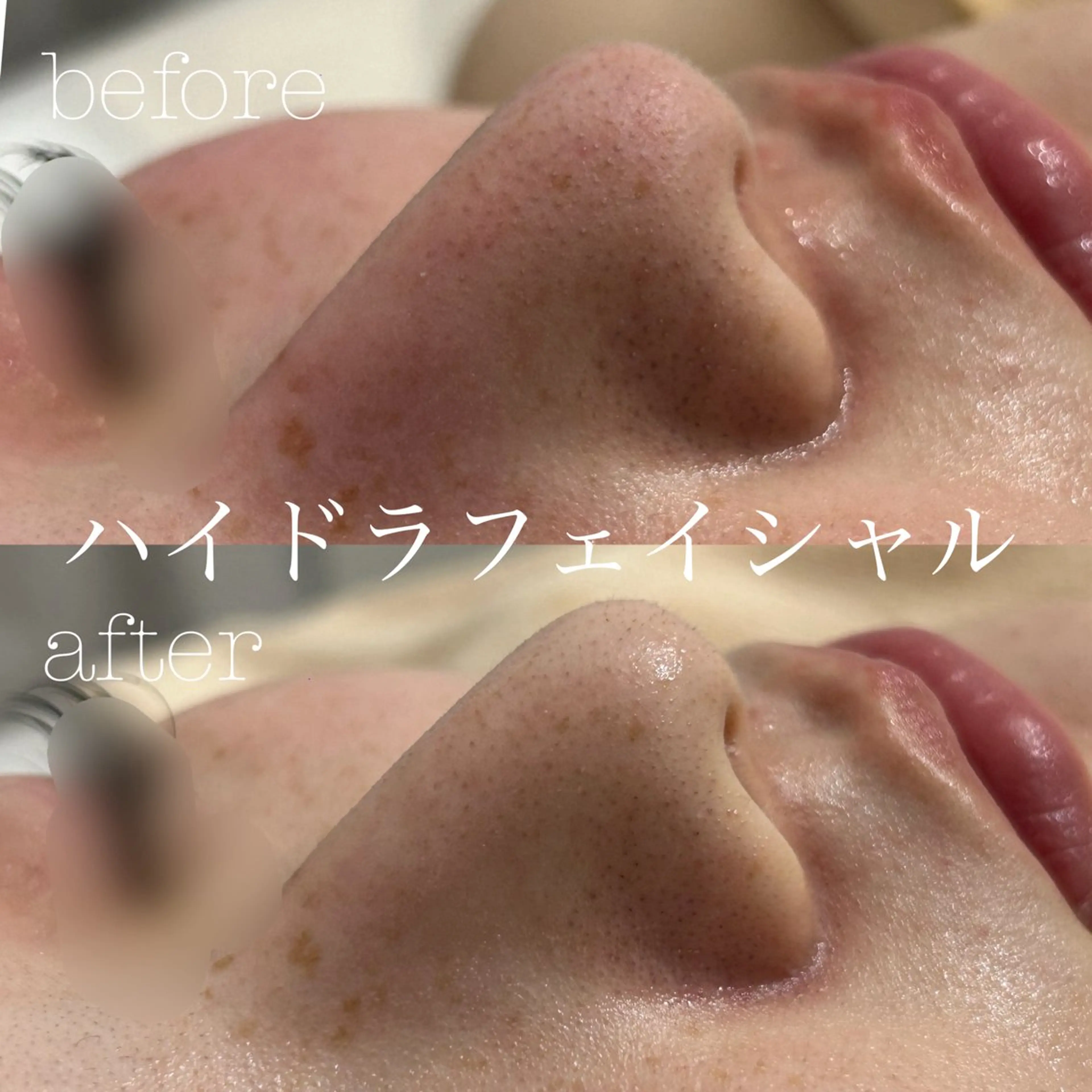 エステ フェイシャルサロン CHIARA 荒田のエステ・リラクイメージ