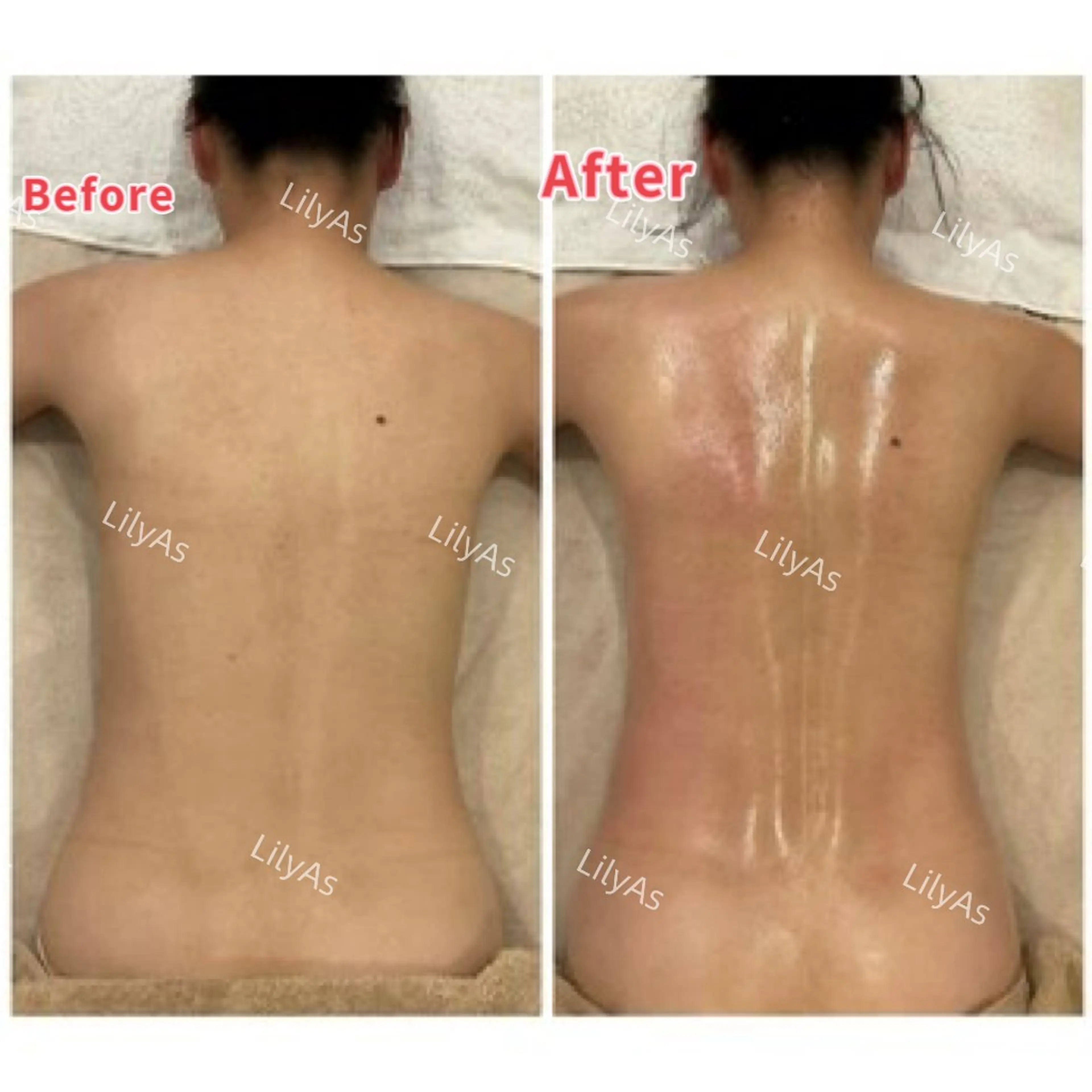 痩身&小顔サロン L i l yA sのエステ・リラクイメージ