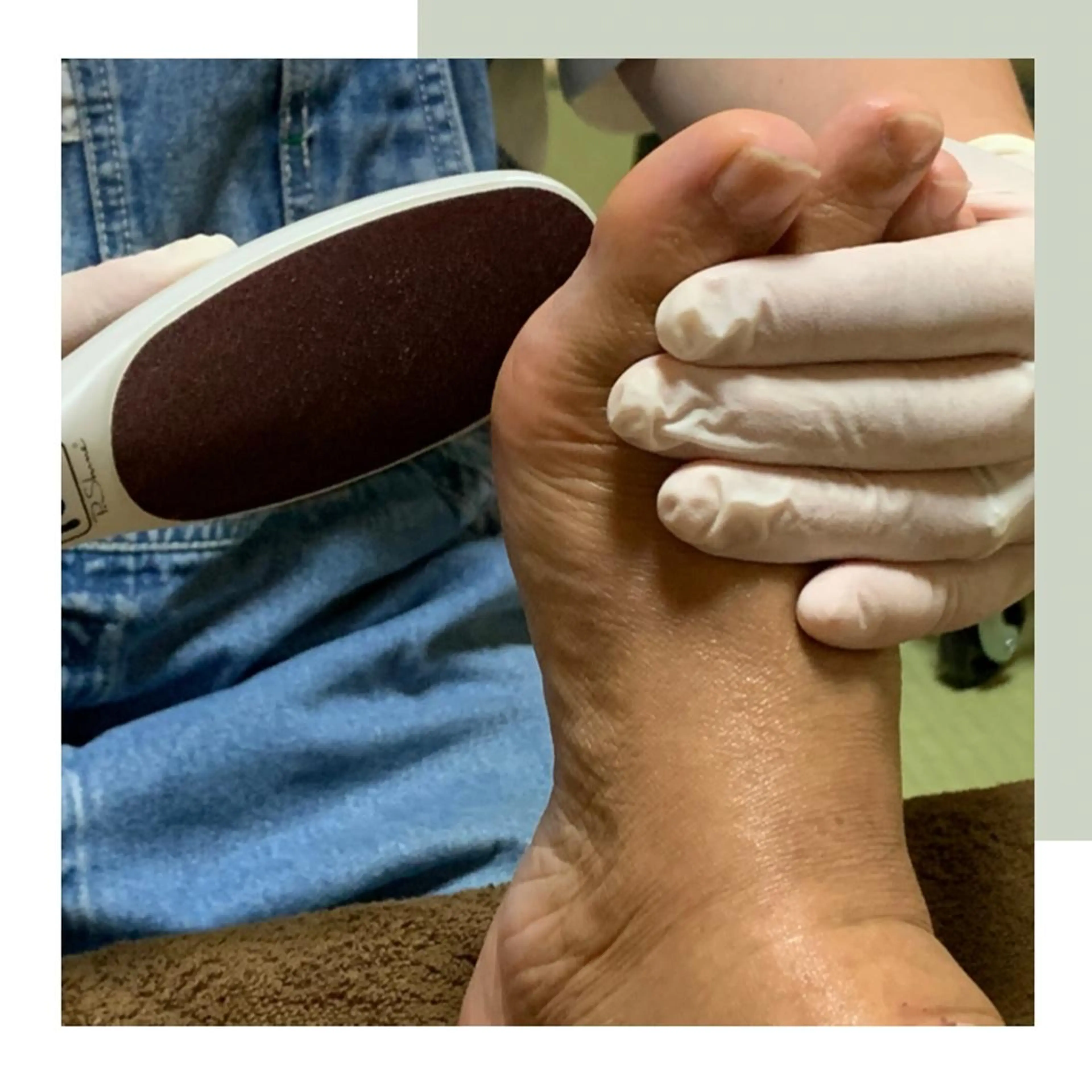 足裏角質ケアの写真