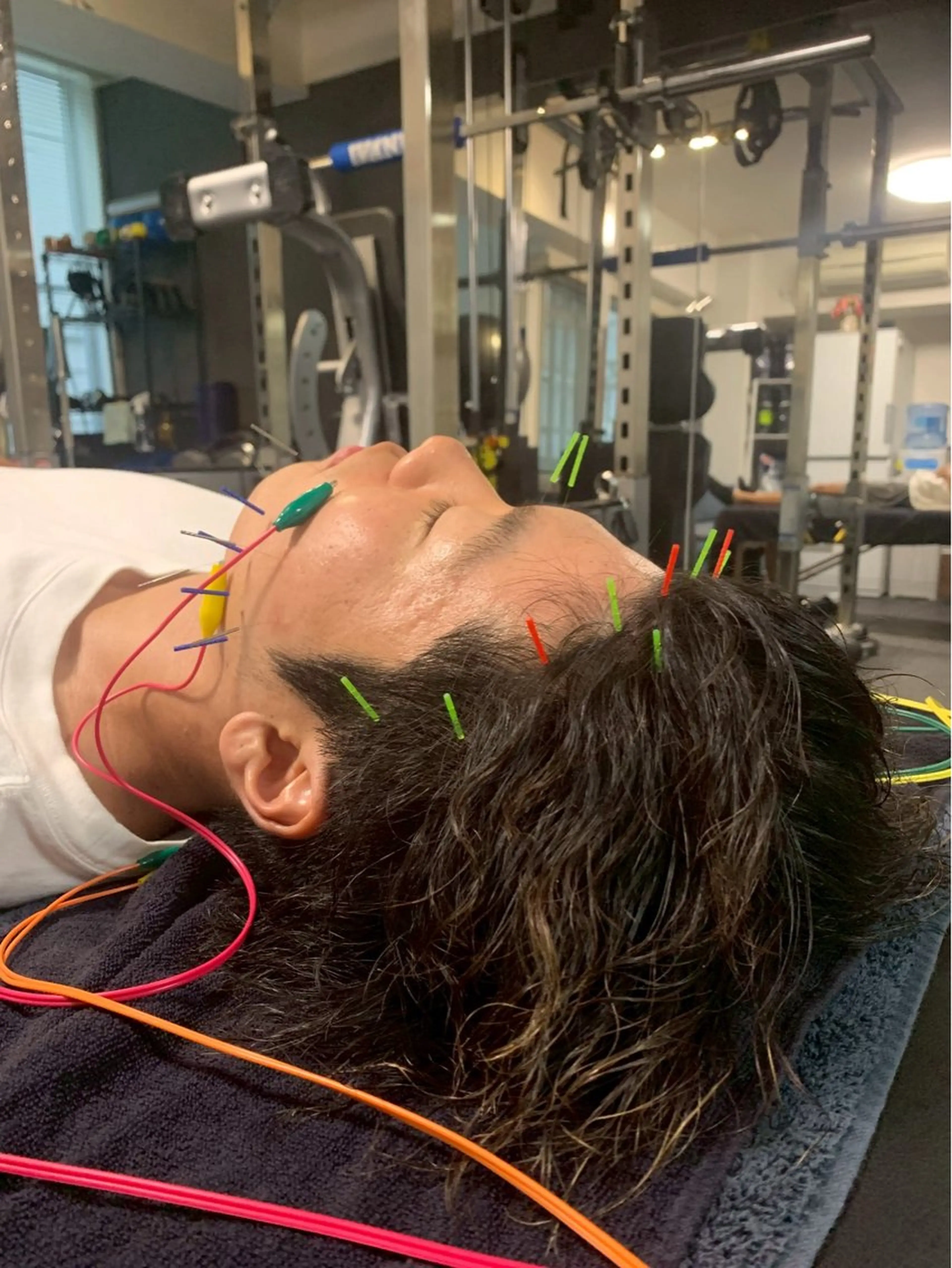 美容鍼・小顔矯正 FLOW 鍼灸整体院のその他イメージ