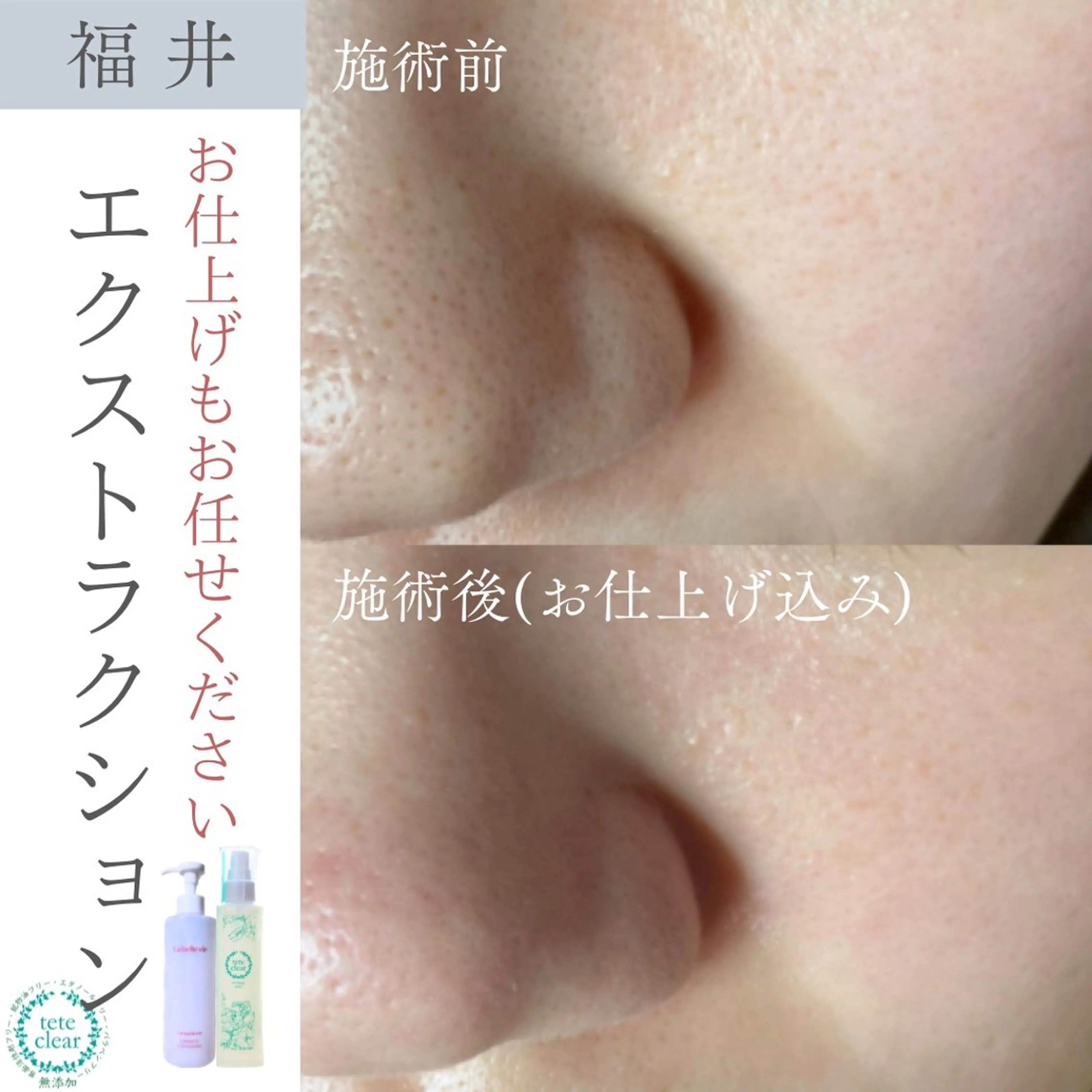 毛穴肌質ケアサロン Yourmeユアミーのエステ・リラクイメージ