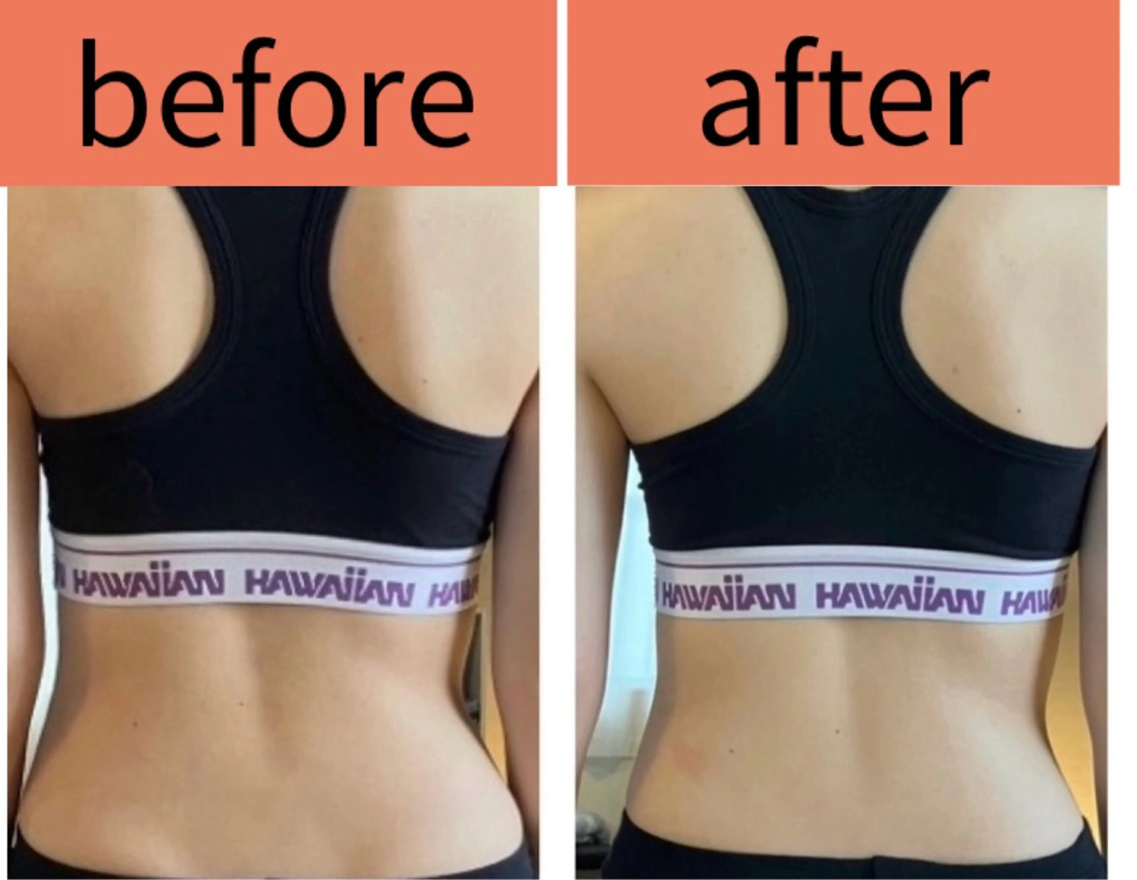 その他 ひかり 整体のエステ・リラクイメージ