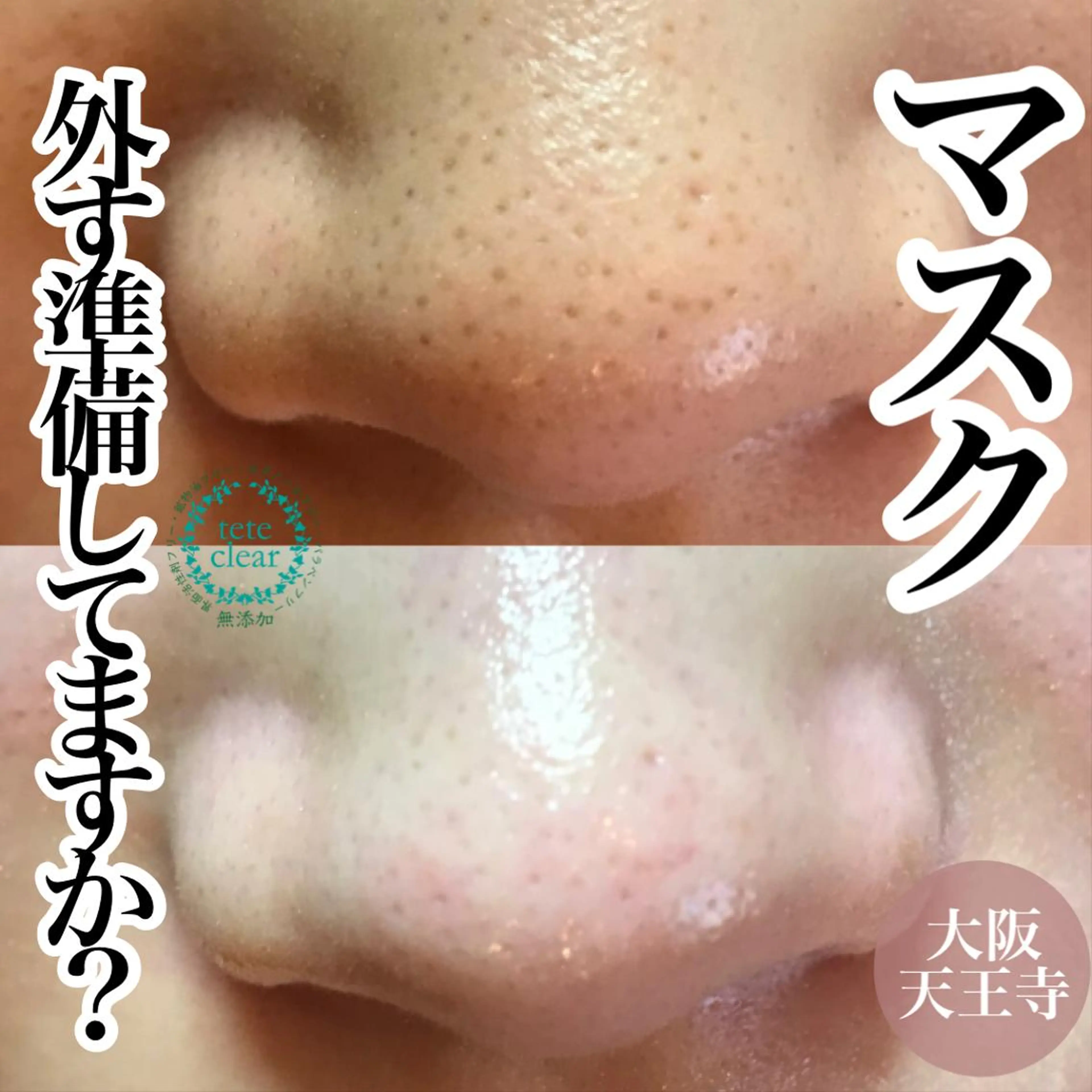 【しみ毛穴専門店】beautysalon Ankh所属・しみ毛穴専門店 Ankh 平田のエステ・リラクイメージ