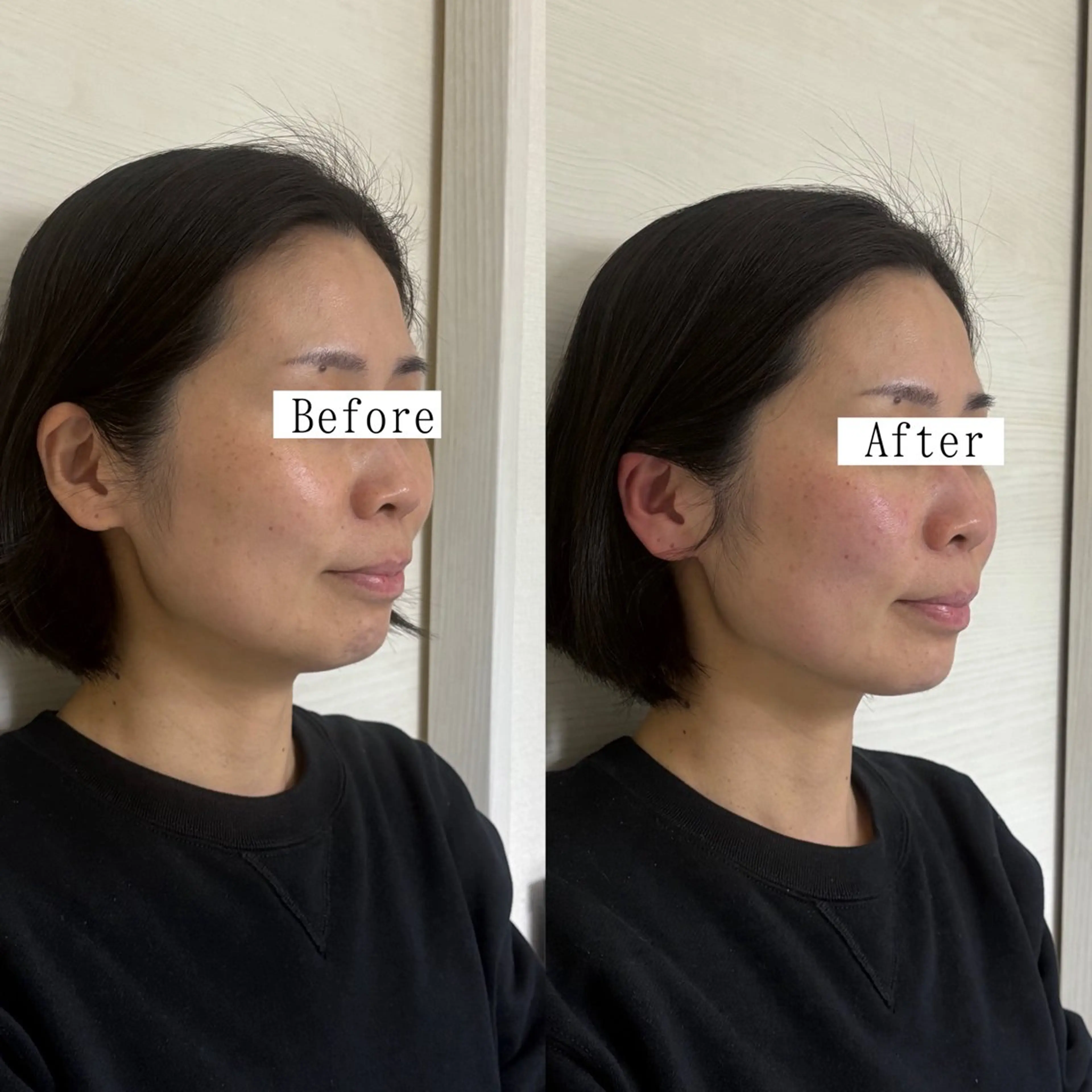 Private salon La.所属・Stellum 小顔矯正&ヘッドスパのエステ・リラクイメージ