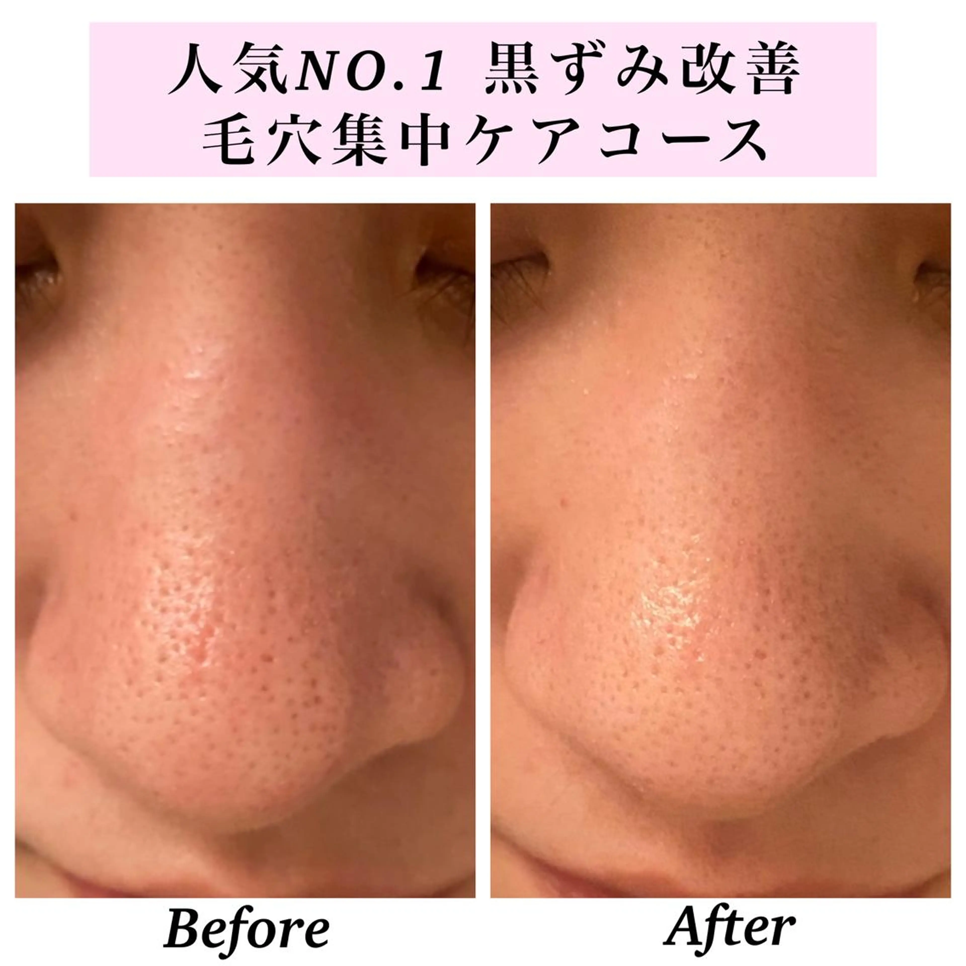 エステ リラク Bellesthe (ベルエステ)のエステ・リラクイメージ