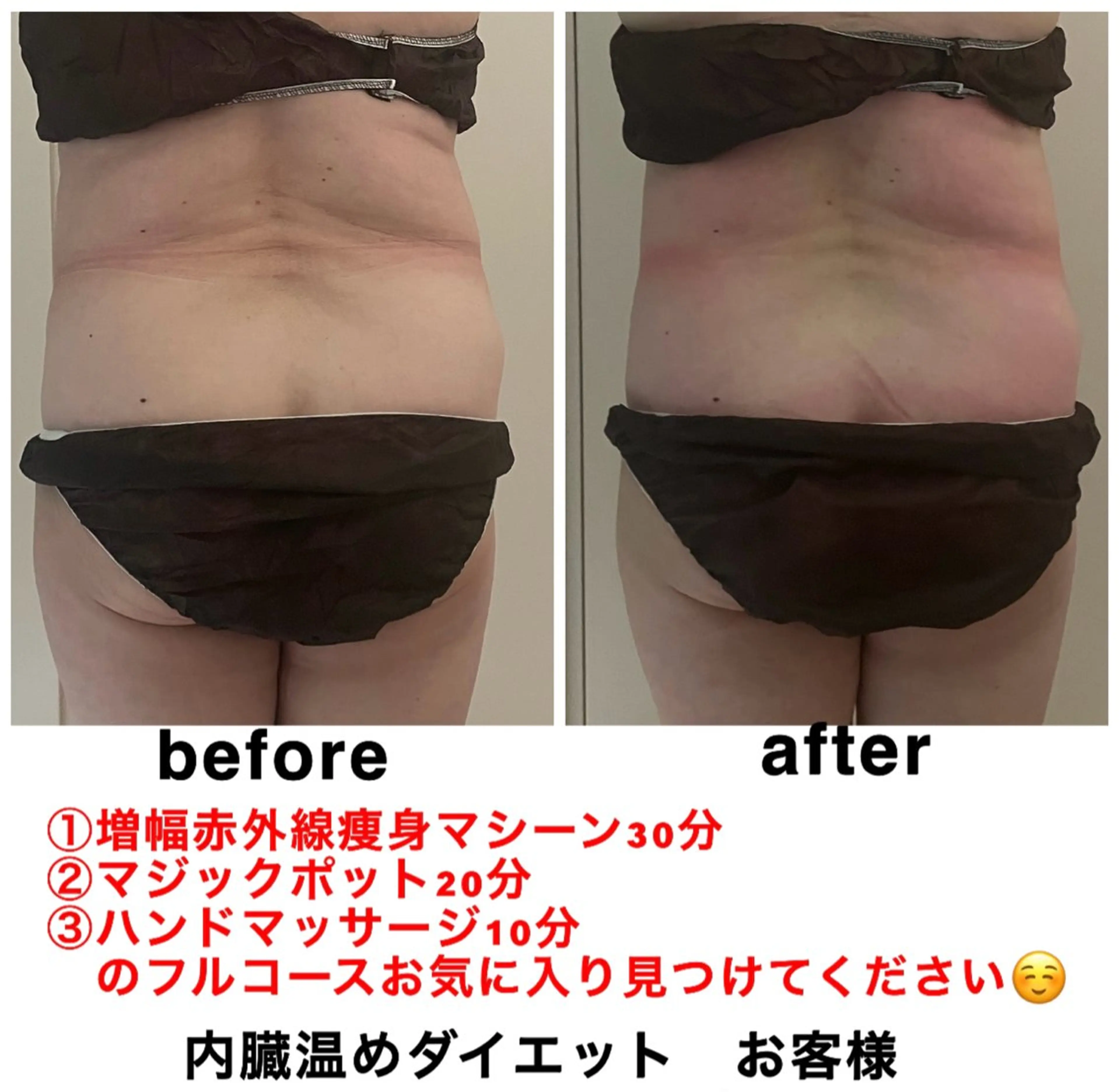 エステ ネイル・エステサロンUILANI所属・ネイル・エステサロン UILANIのネイルデザイン