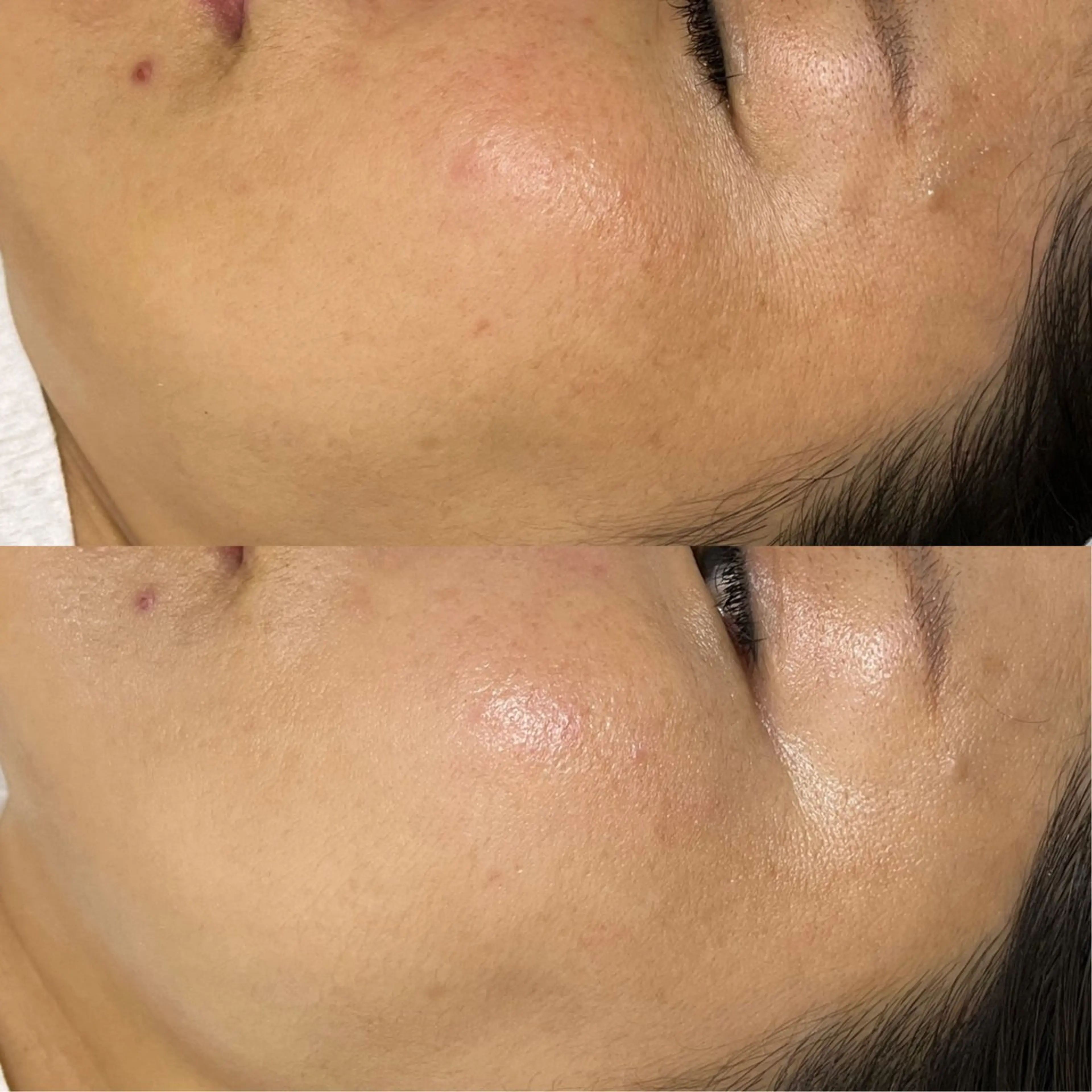 エステ Rifuro毛穴ケア &よもぎ蒸しサロンのエステ・リラクイメージ