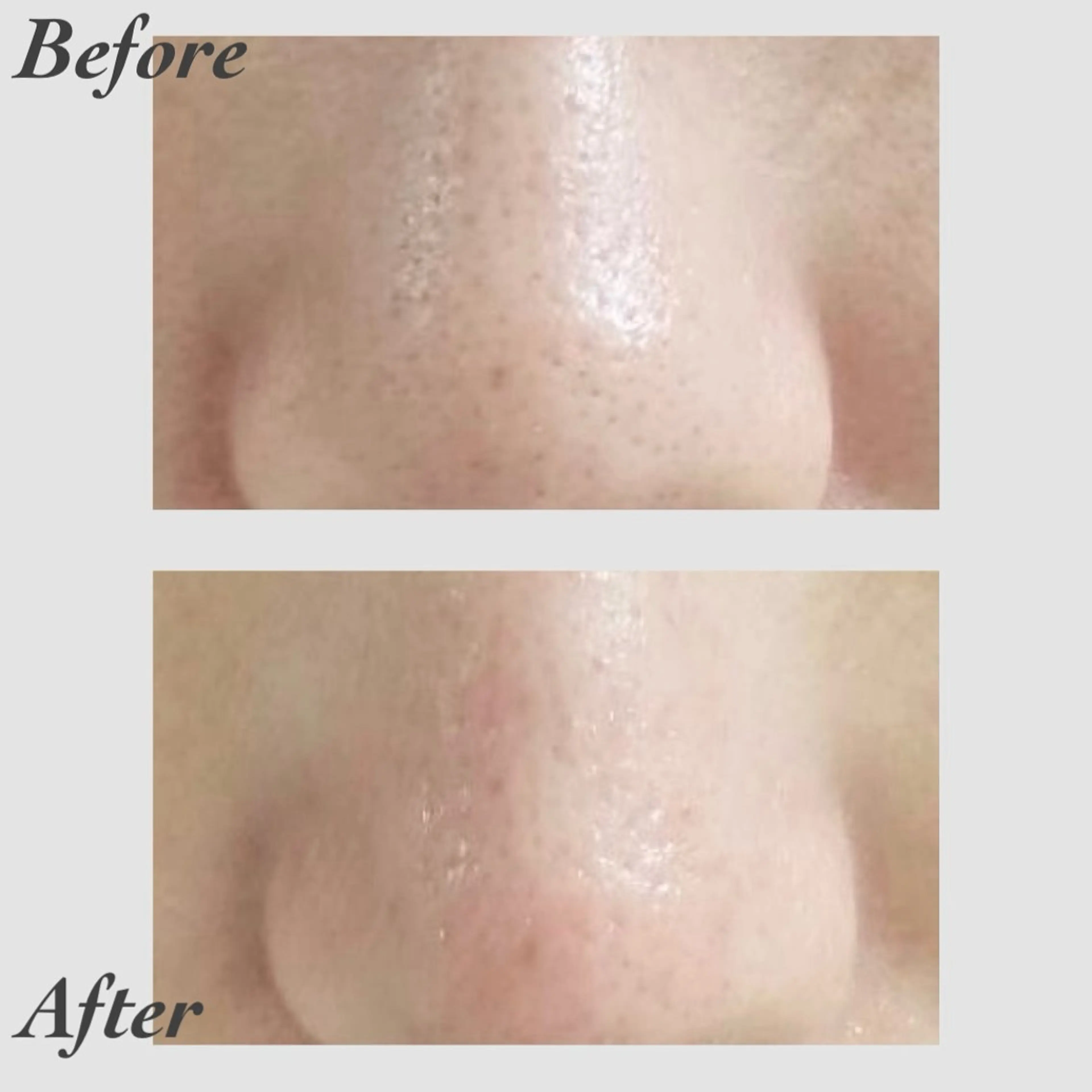 小顔・ツルツル素肌 ハリステリアのエステ・リラクイメージ