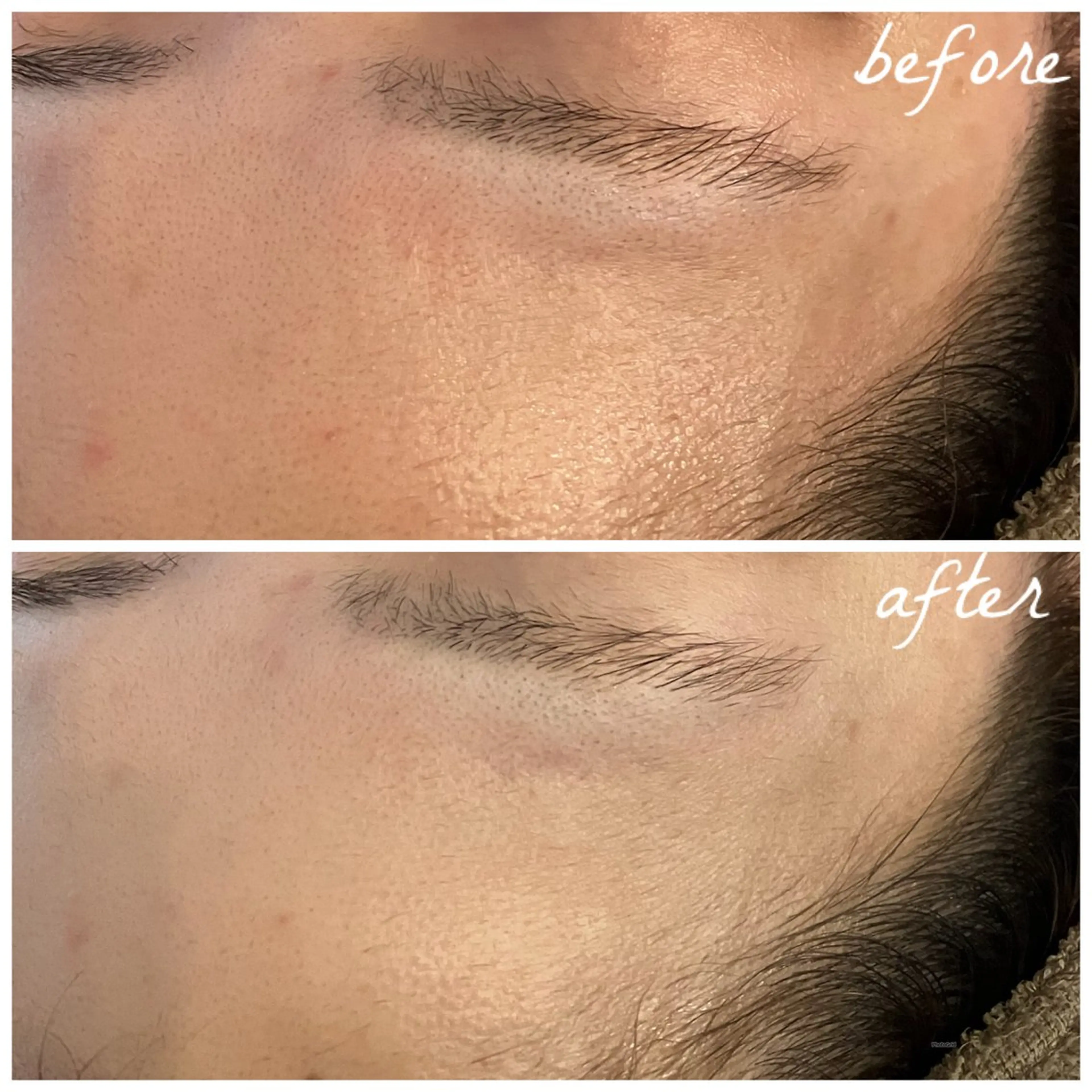 メンズ エステ メナード岐阜茜部 杉浦のエステ・リラクイメージ