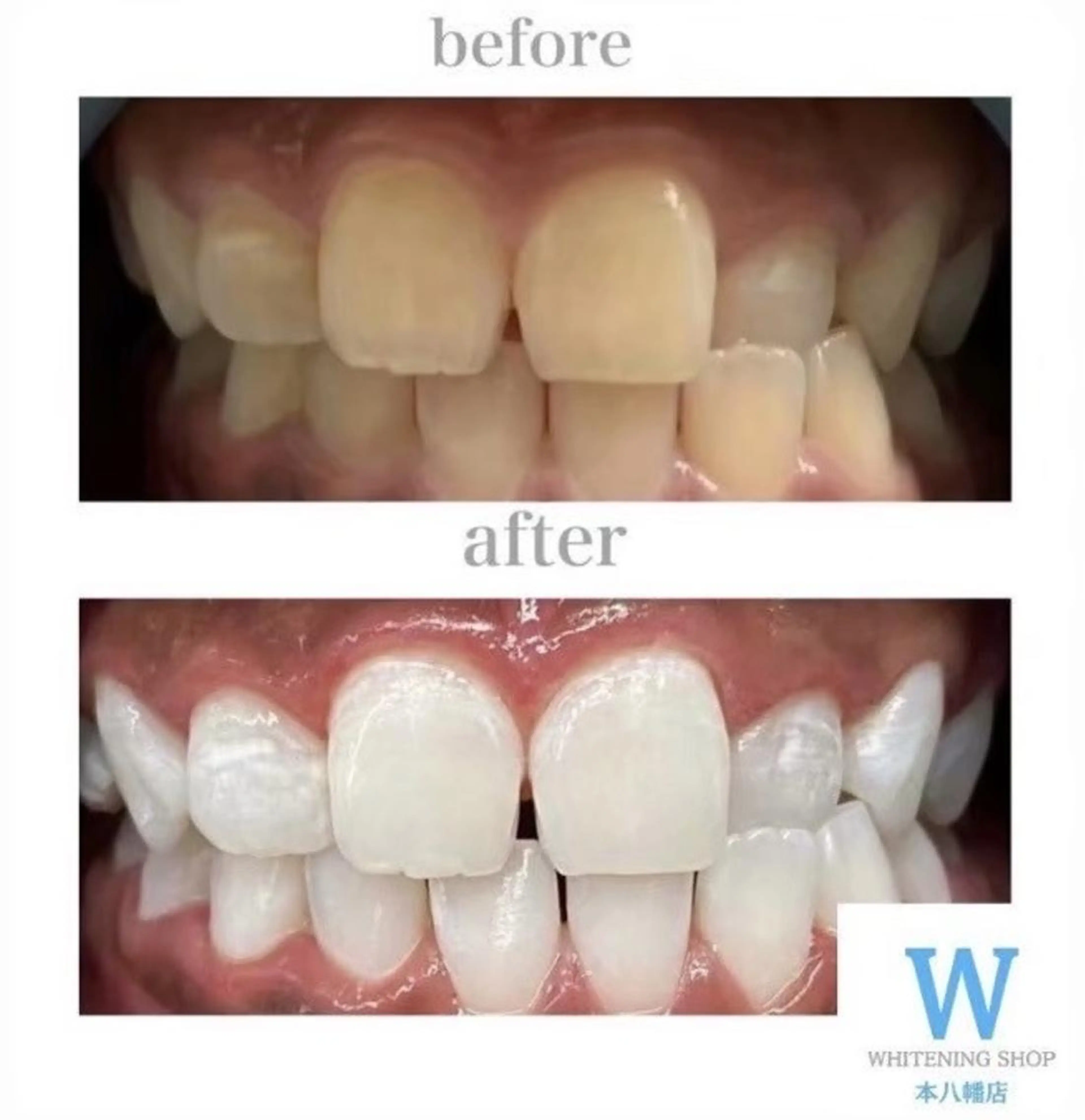 ホワイトニング ショップ本八幡店のエステ・リラクイメージ