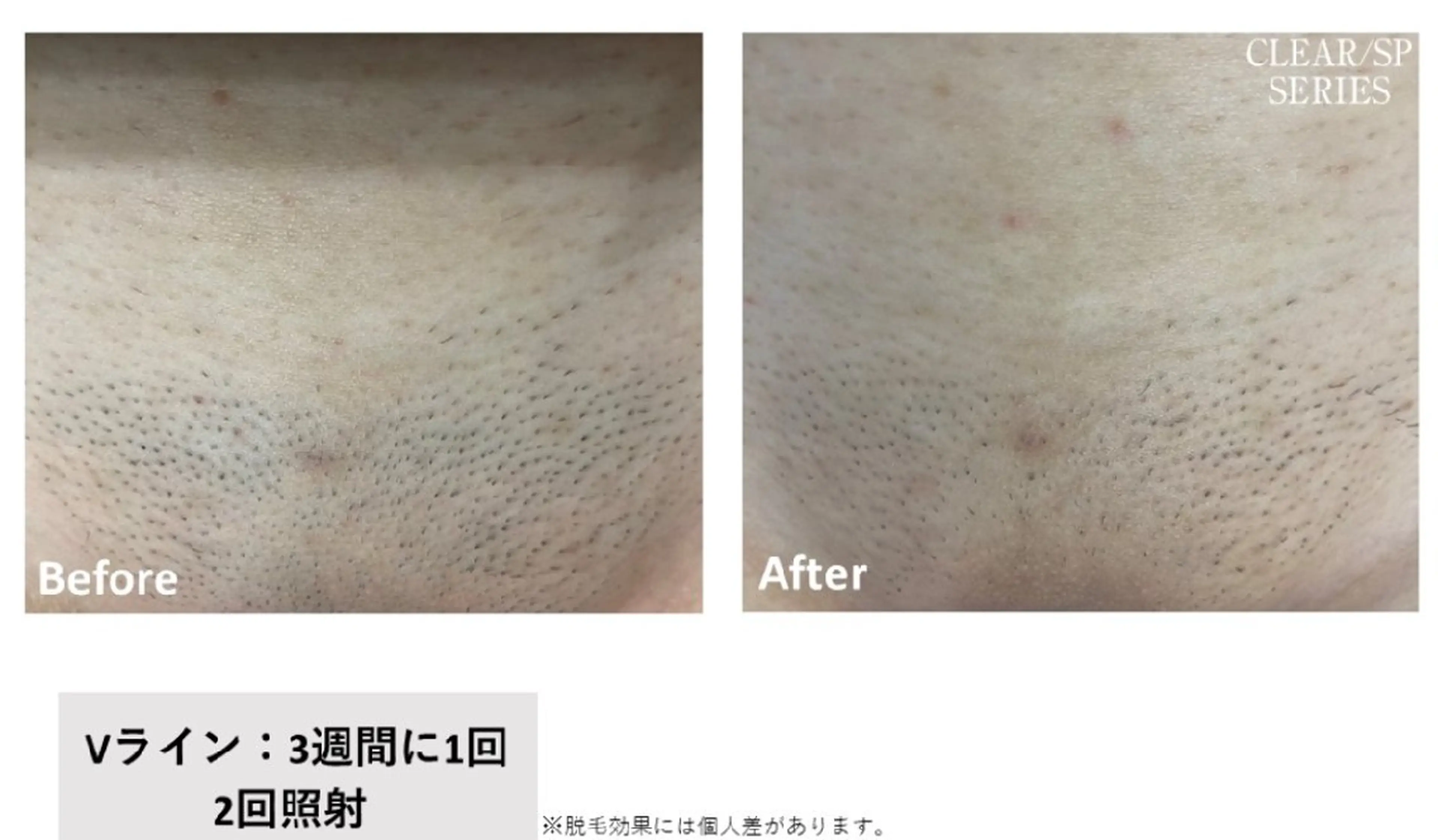 viage所属・viage 脱毛&フェイシャル店のエステ・リラクイメージ