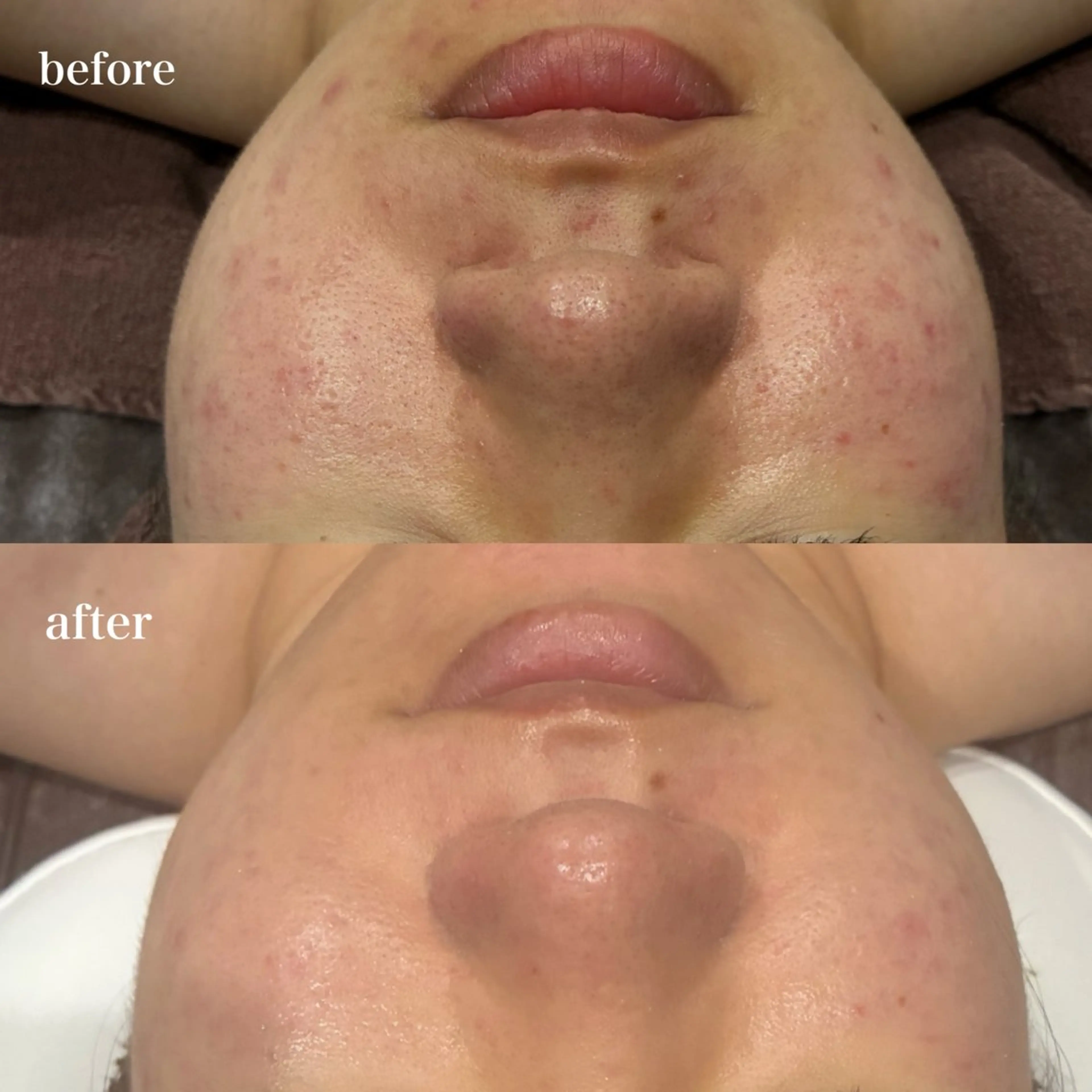 エステ DahliaBeauty ダリアビューティー所属・DahliaBeau tyフェイシャル中村のエステ・リラクイメージ