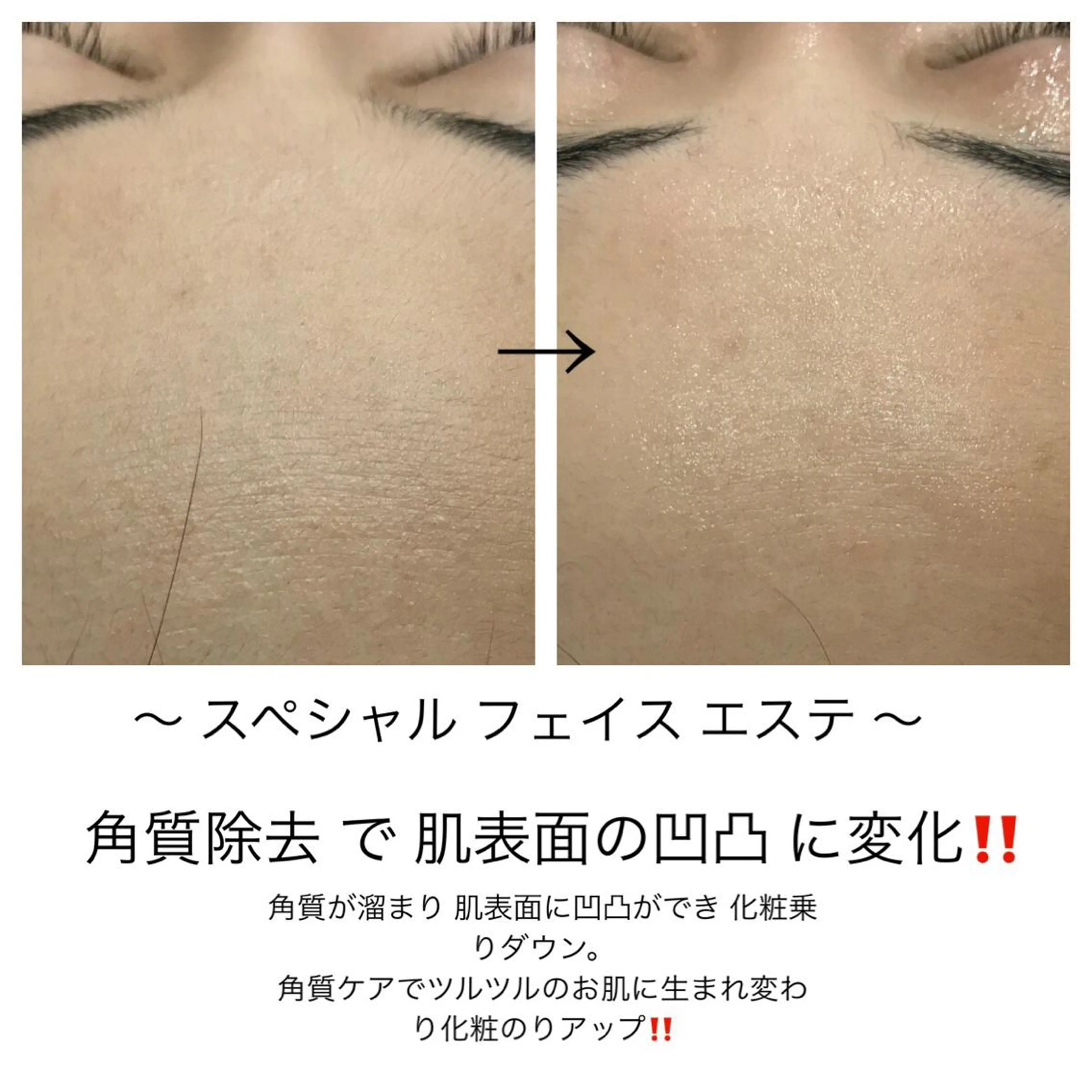 ビューティー ミロワールのエステ・リラクイメージ