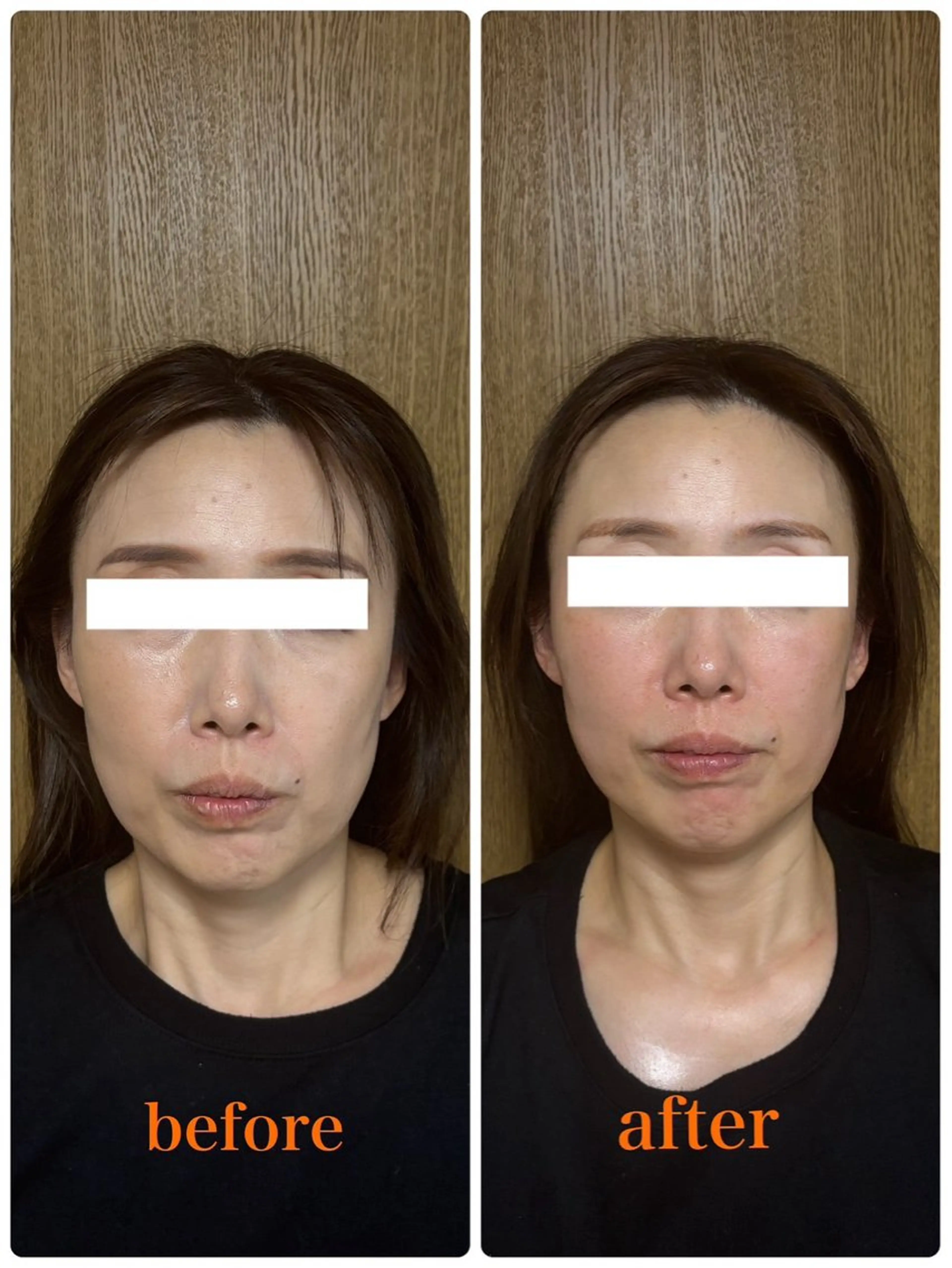 アイラッシュサロンLea所属・阪口 裕美のマツエク・マツパデザイン