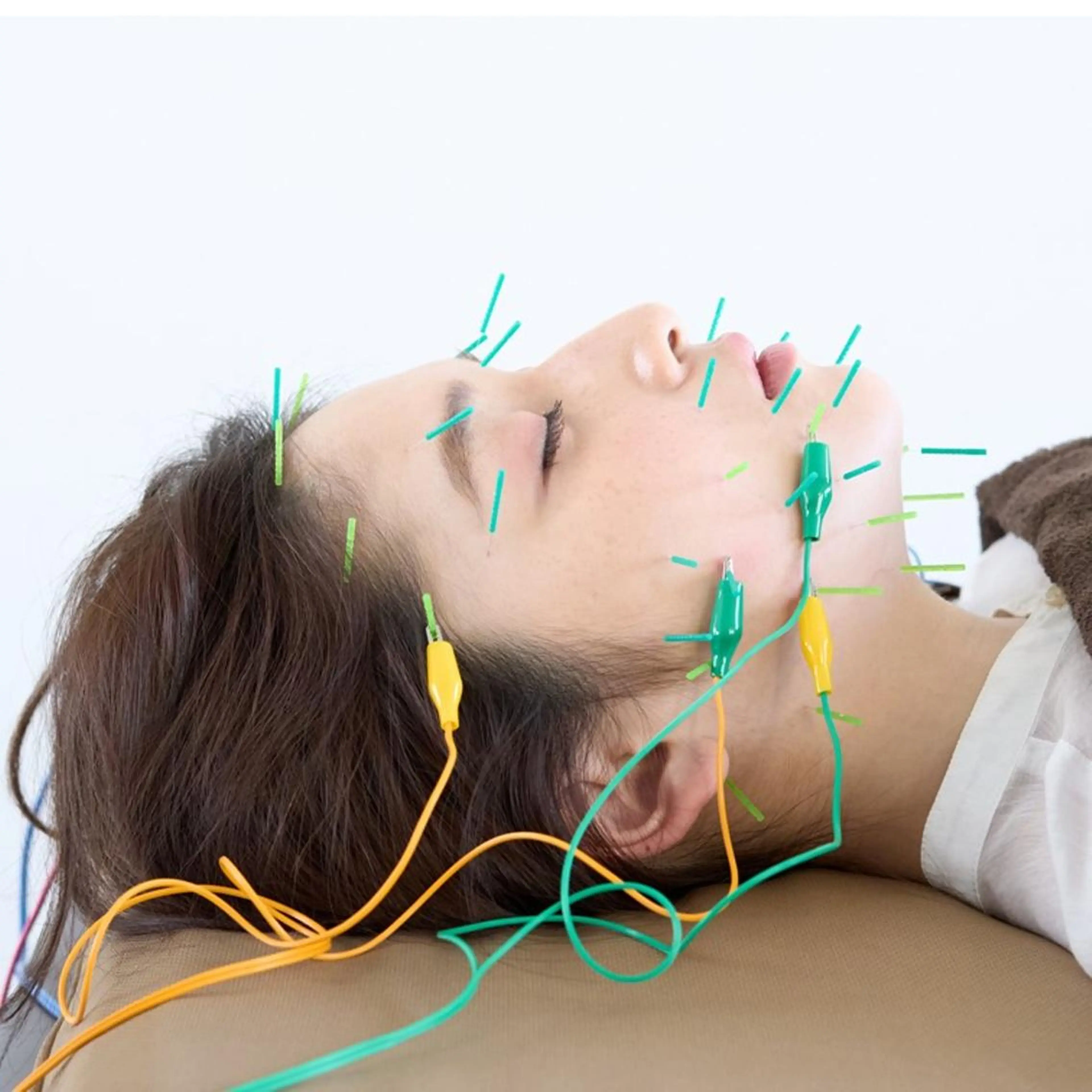 美容鍼50本＋小顔マッサージ＋保湿仕上げの写真