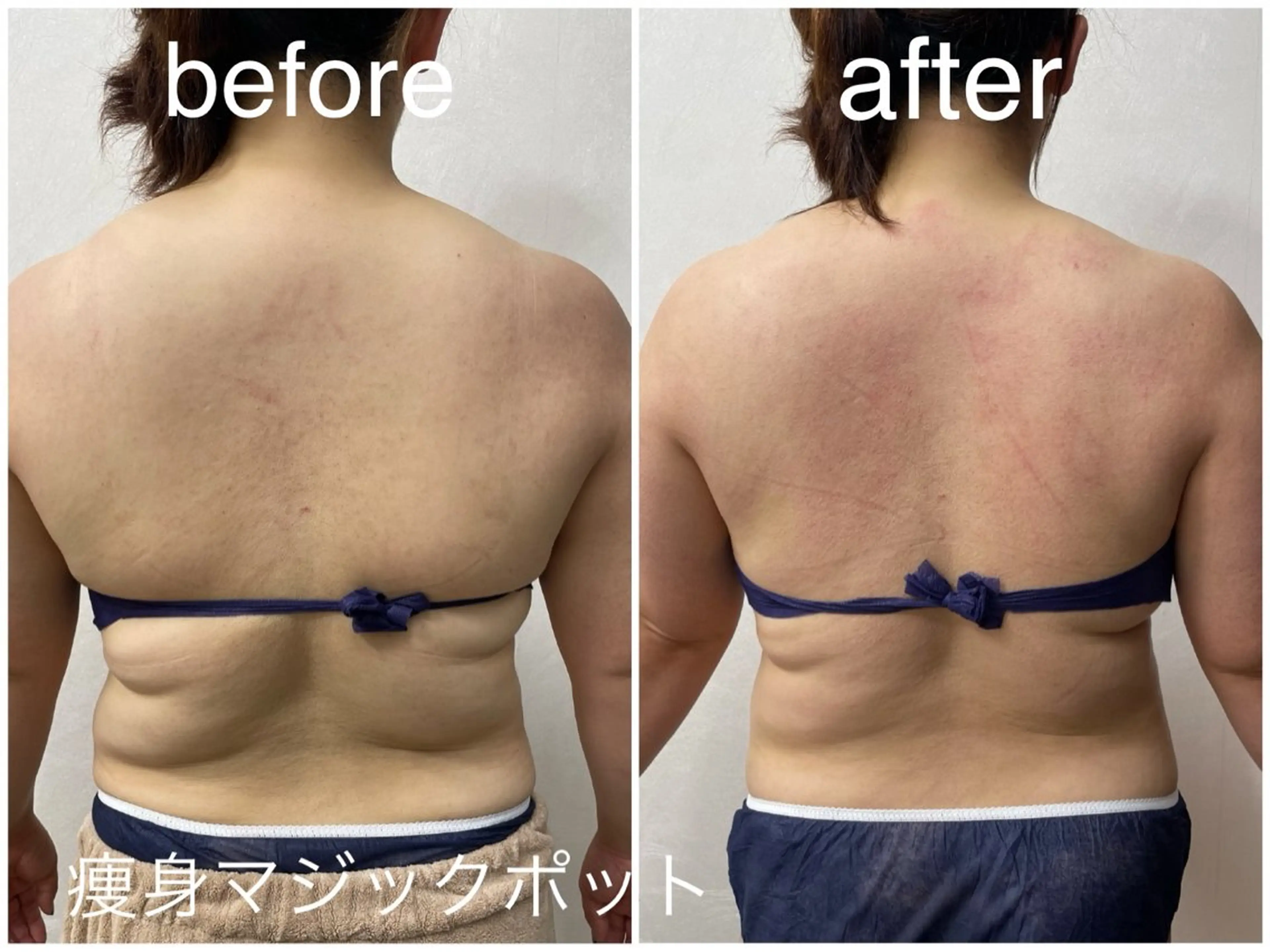 エステ Reid-月詠-所属・Reid -月詠-のエステ・リラクイメージ