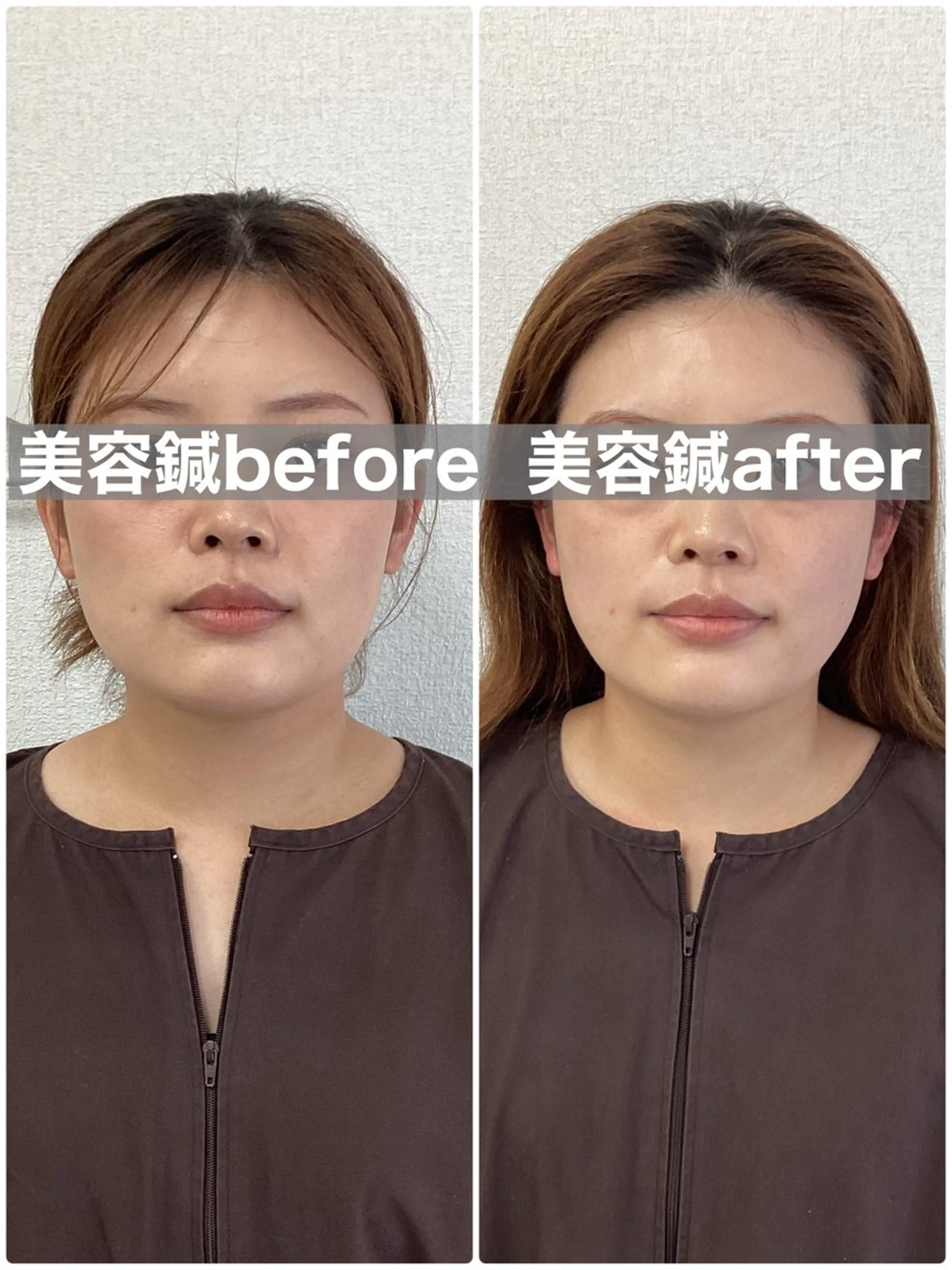 エステ リラク メディカルサロンドオフ所属・ハリサロンドオフ 美容鍼灸×小顔整体のエステ・リラクイメージ